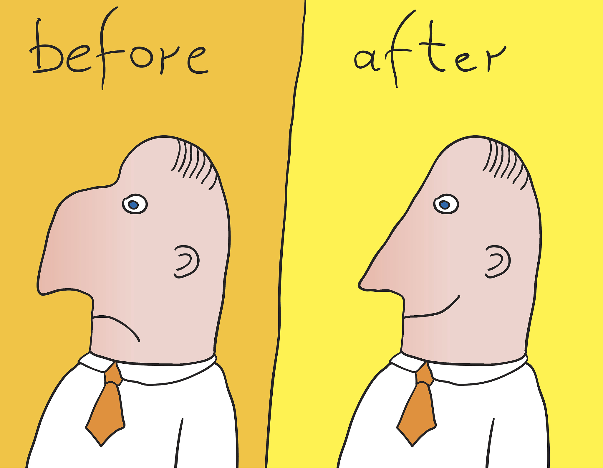 200字隆鼻微博文案