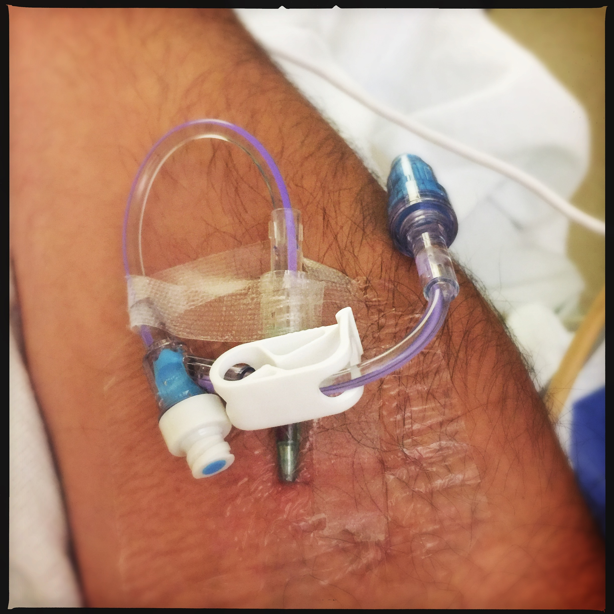 CEUS在胆管疾病中的应用价值 - 提高诊断和治疗效果