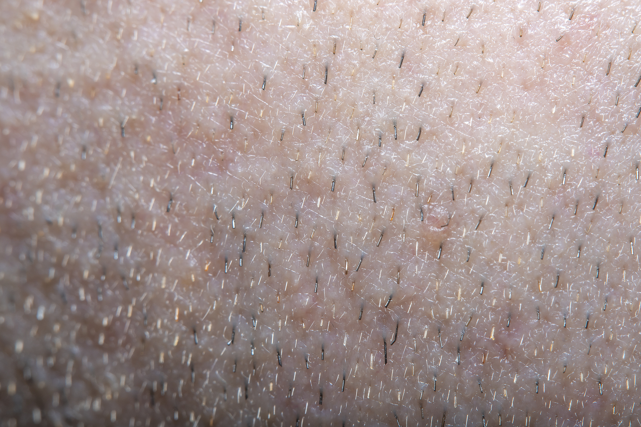 men's skin with the remains of a shaved beard in soft focus with