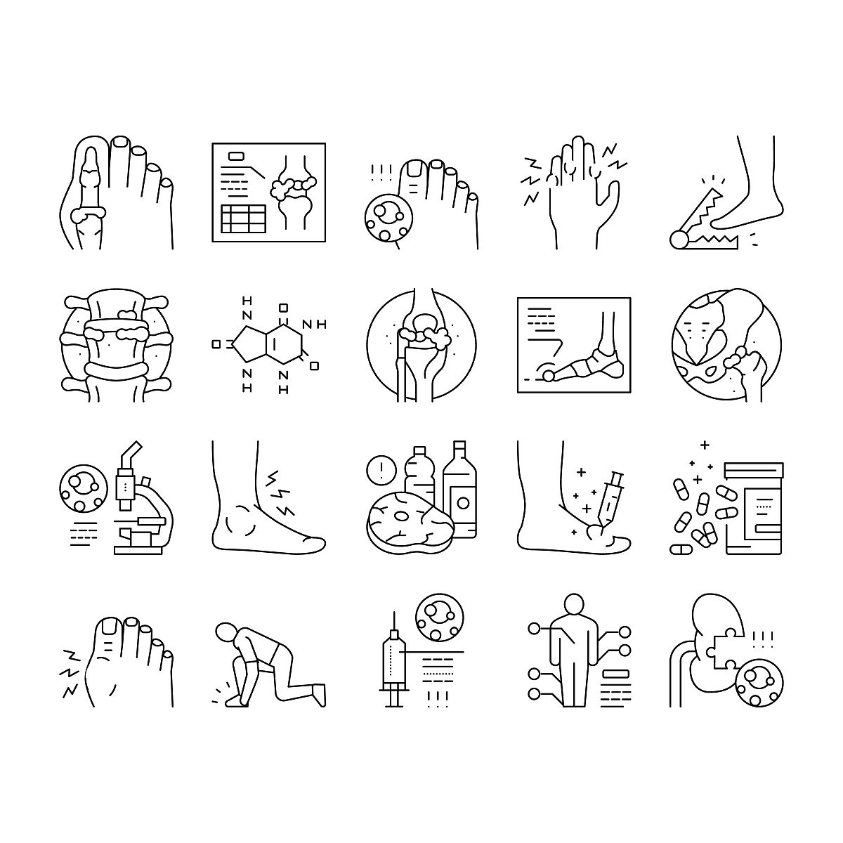 高嘌呤食物清单：哪些食物会导致痛风？