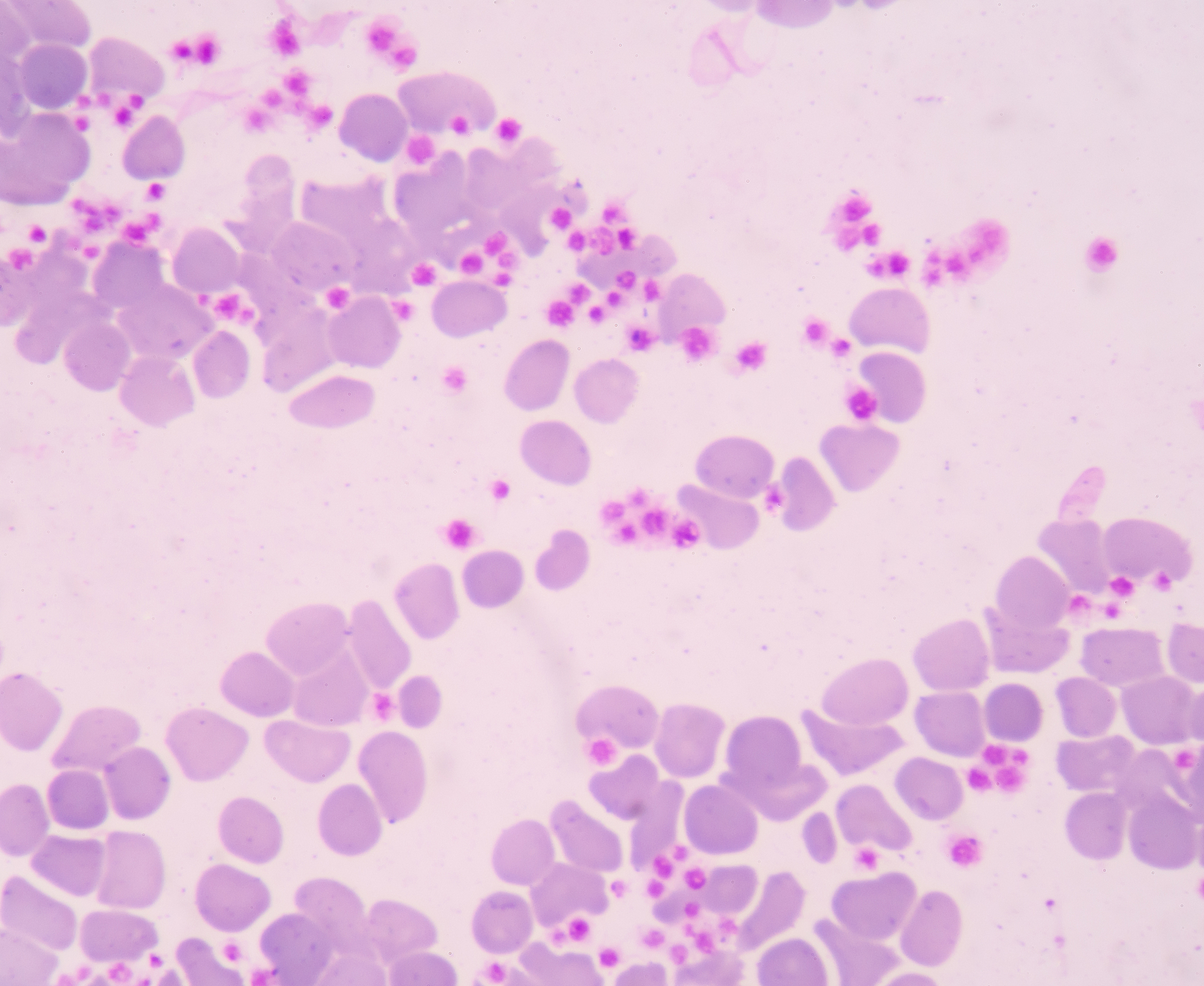 请翻译并概括下面这段英文：The role of platelets in both the initiation and propagation of cardiovascular disease has been firmly established over the past 2 decades1–3 The importance of platelets in cardiovascular