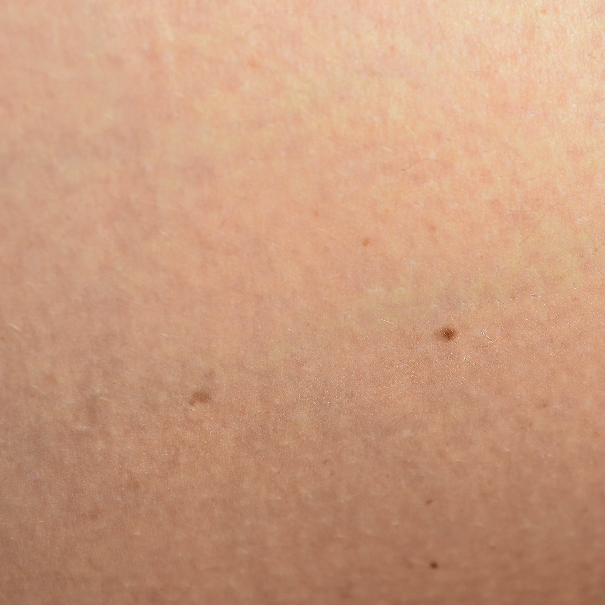 male skin texture background