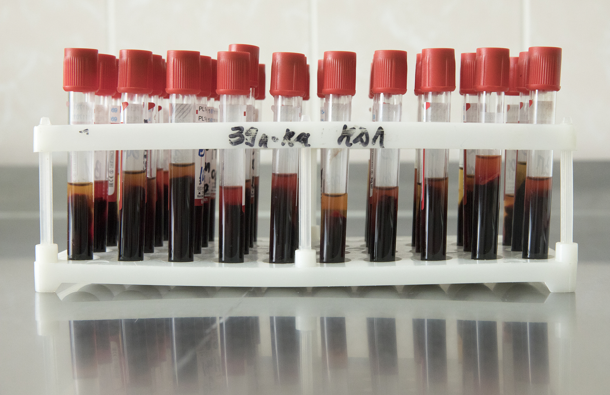 贵阳护理职业学院医学检验专业就业前景怎么样