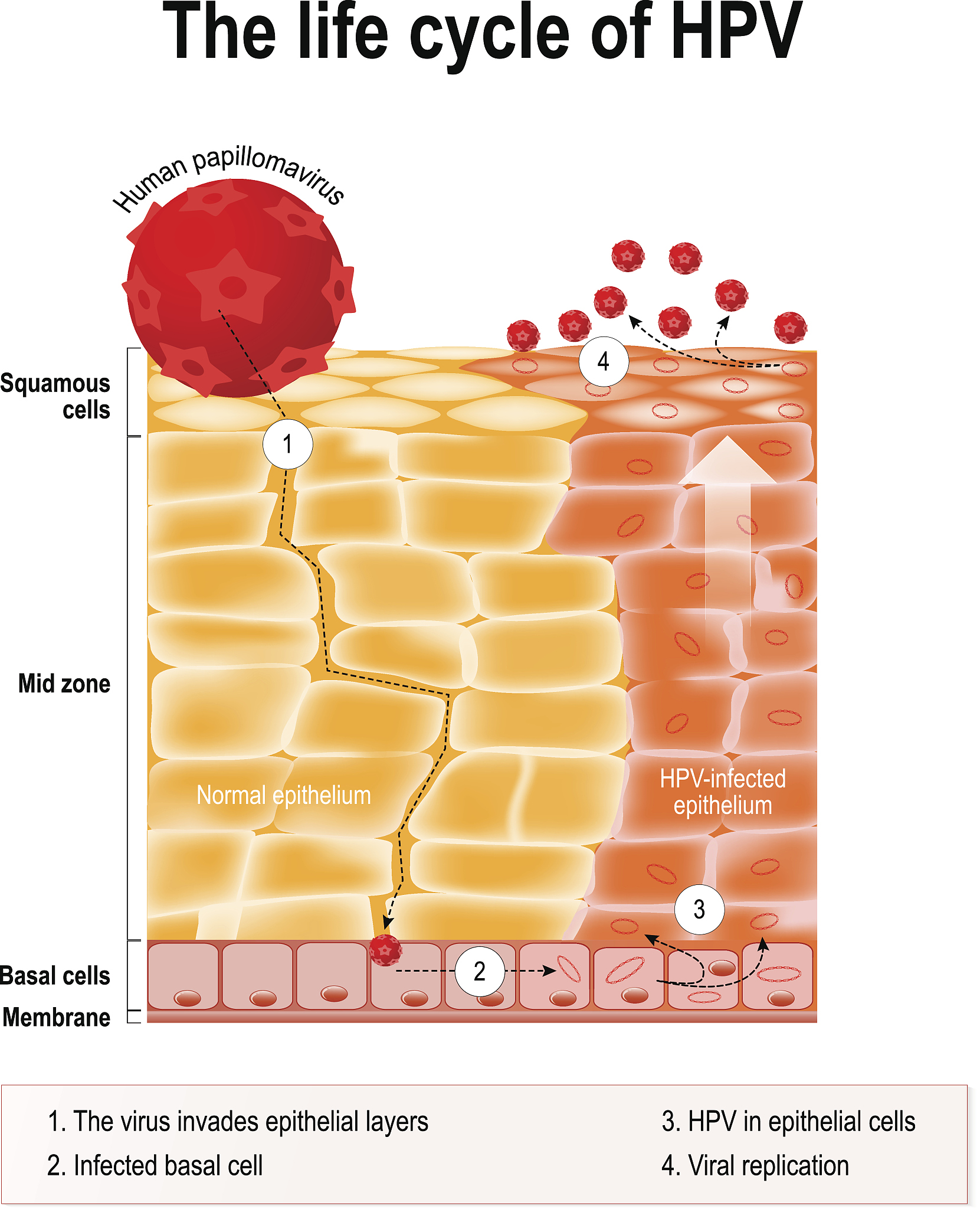 HPV疫苗可以有效预防女性宫颈癌的发生但是男性也可以接种疫苗从而预防一些与HPV病毒有关的疾病。 把这段话改成一首诗
