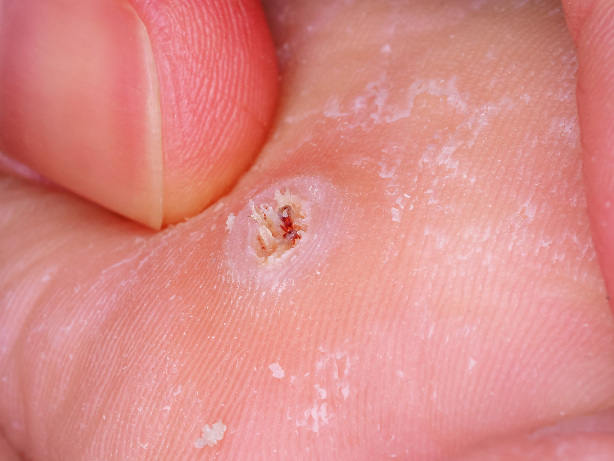 中设置适当的温度和光照进行培养。第6步：愈伤组织的诱导1 在适当的培养条件下向组织中添加生长调节剂如萘乙酸NAA和六-苯基腺嘌呤BA激发其生长和分化能力。2 观察组织的生长情况包括组织颜色、形态以及增殖程度等判断愈伤组织的形成状况。3 可根据愈伤组织的发育情况适时加入适宜生长调节剂以促进其增殖和分化。第7步：愈伤组织的分化1 将生成的愈伤组织移植到新的含有生长调节剂的MS培养基中适当降低生长调节剂