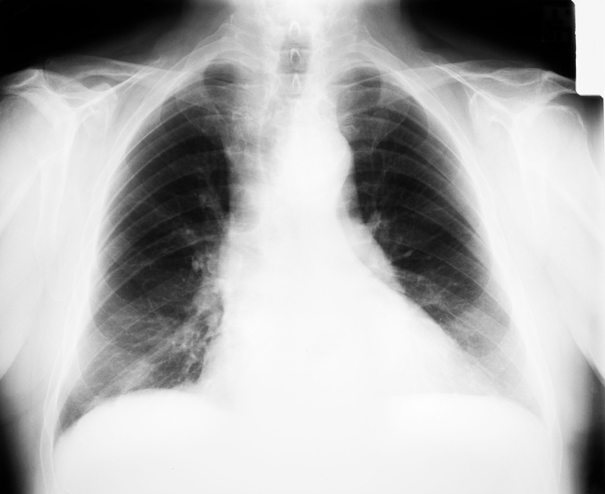 以下是性价比较高的运动袖套：1 丽迪姿运动臂套：材质舒适透气性好防滑设计价格实惠。2 麦德龙运动臂套：采用聚酯纤维和弹力纤维混纺材料具有超强的抗污性和抗紫外线能力。3 超轻便防晒袖套：超轻便透气性好能够有效地防止紫外线的侵害价格也非常实惠。4 乔山狼运动臂套：采用高弹力材质制造不易变形透气性好穿着舒适。5 原创泥炭运动臂套：采用环保、无毒的材质制造安全健康比较有名气的运动袖套有自己的科技性价比高以