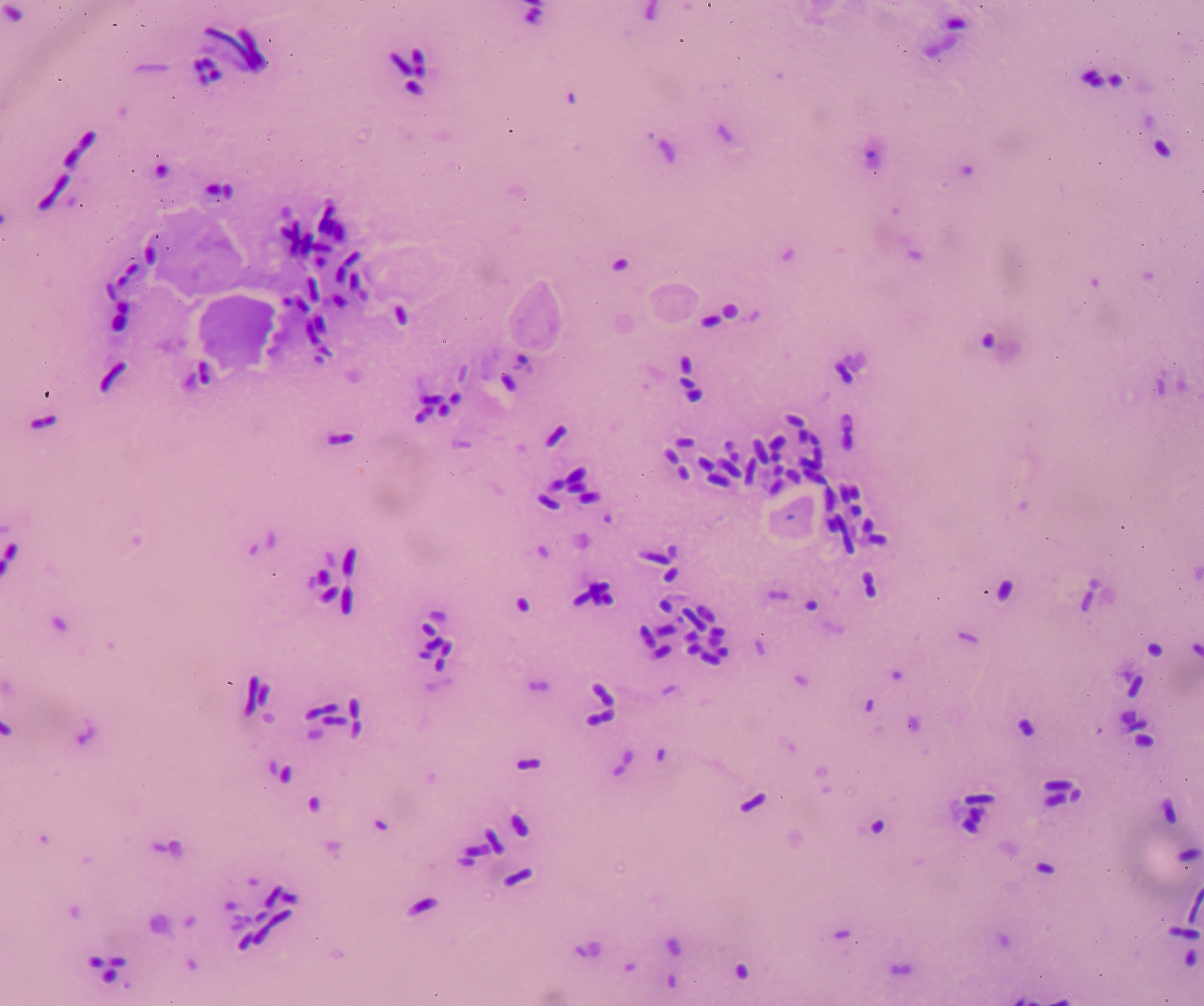中间链球菌：常见细菌，感染风险及预防措施