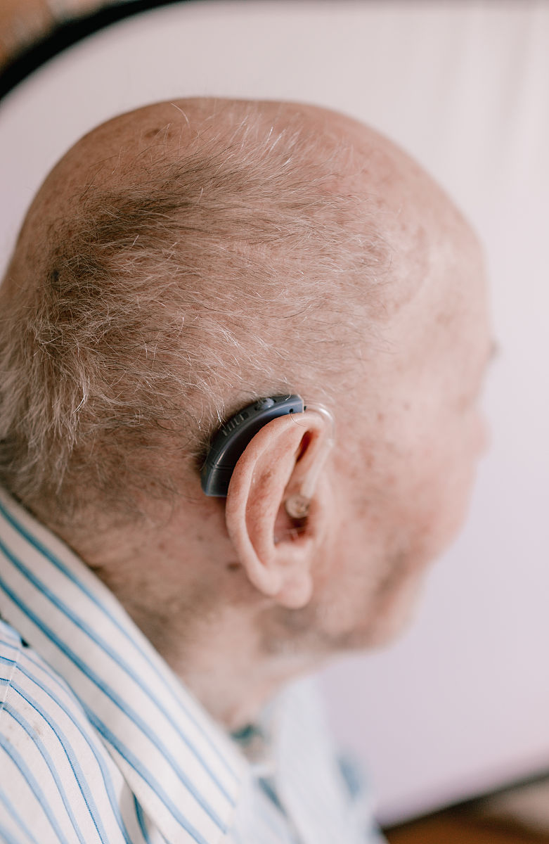 外耳道多毛症治疗未来展望：更精确、便捷、个性化