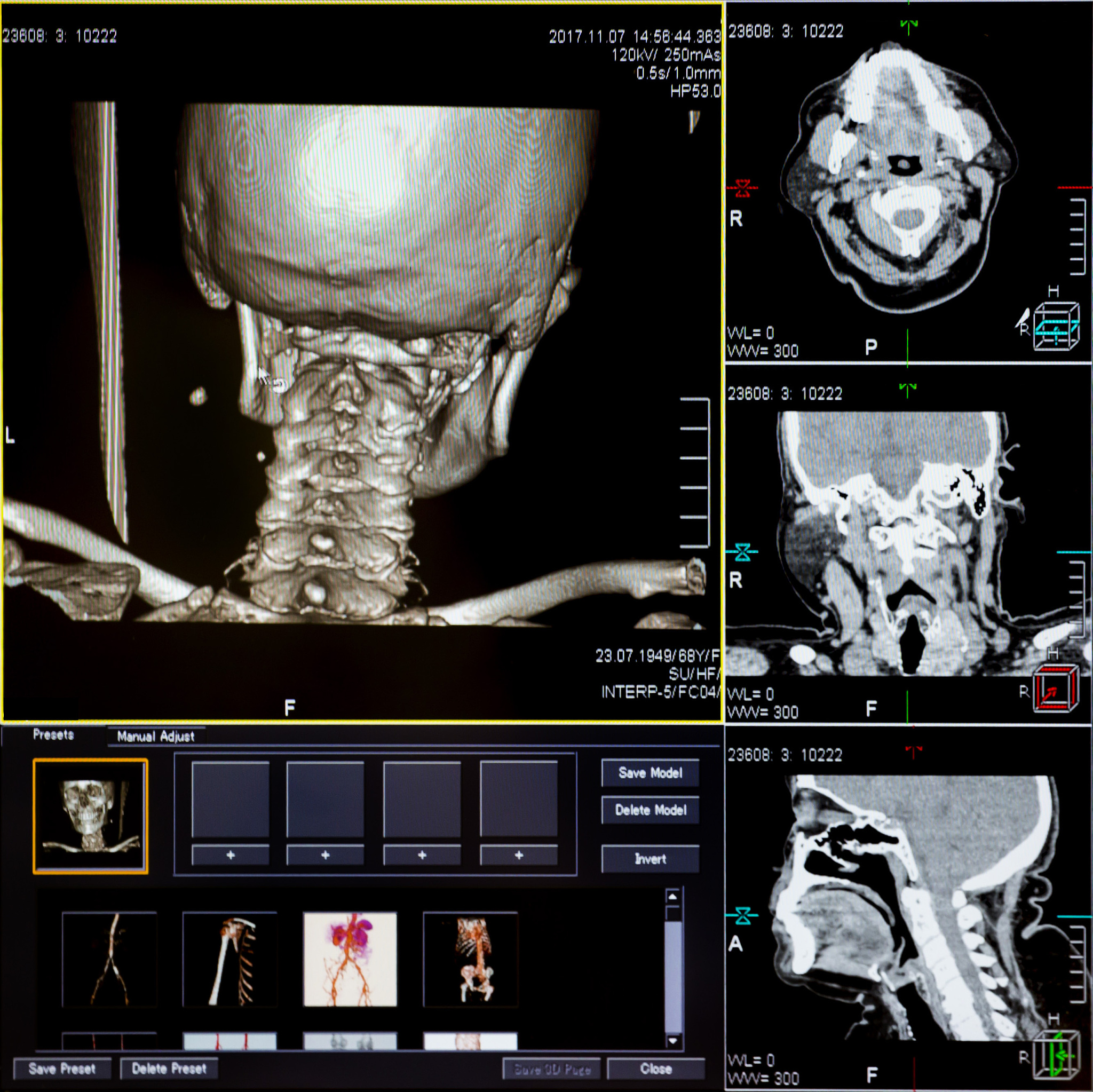 Download CT Images in DICOM Format with Hounsfield Scale