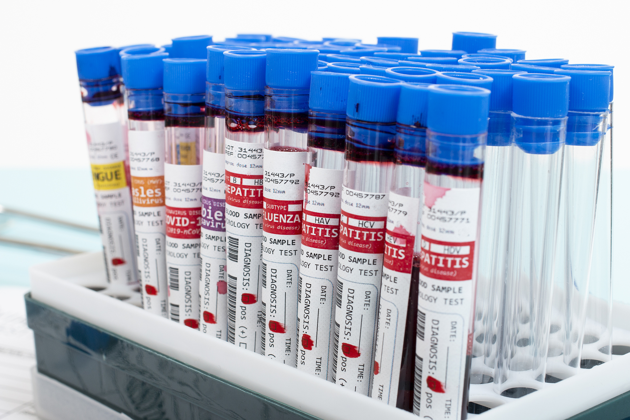 2019年德宏州中等职业学校医学检验技术专业招生