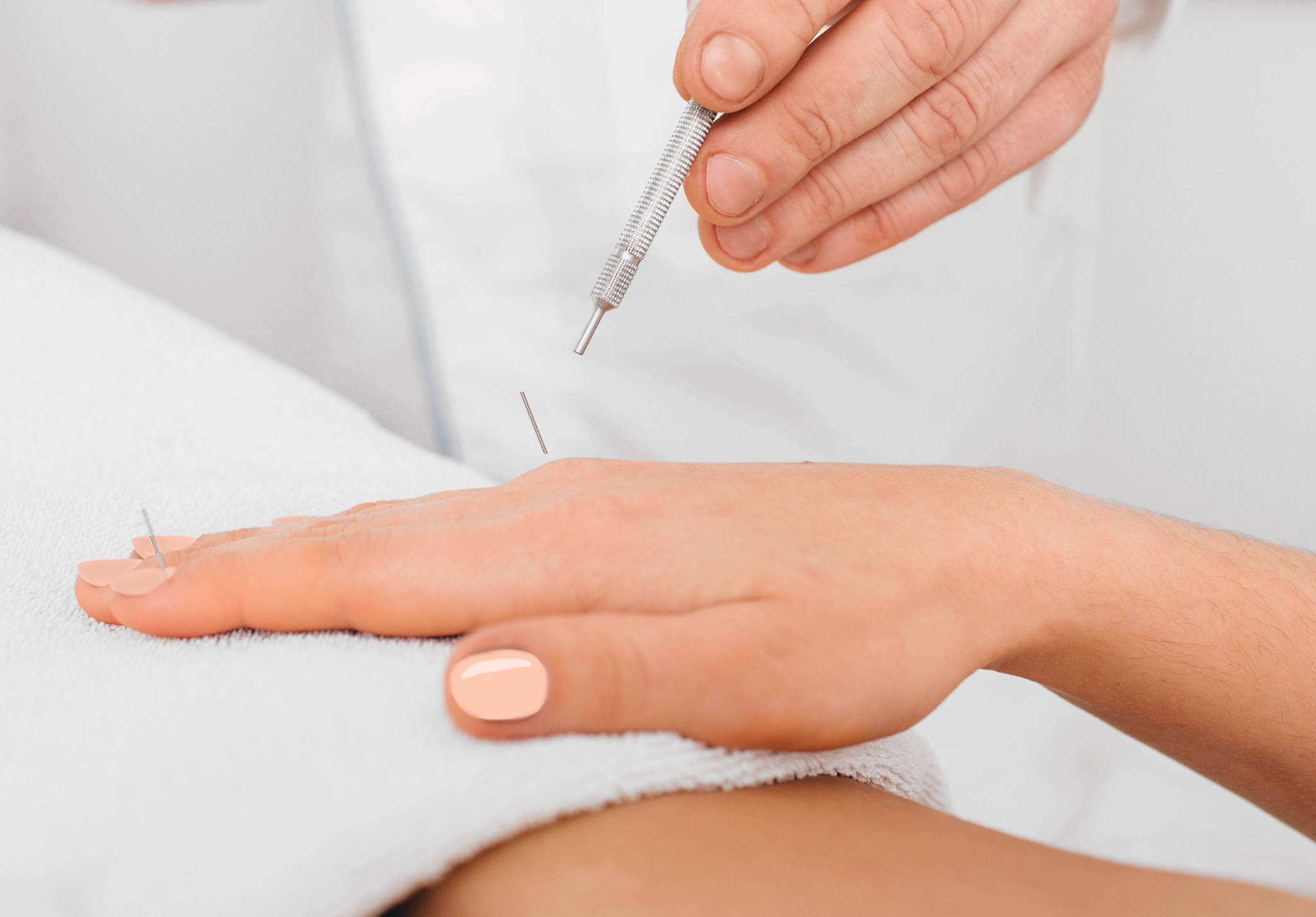 client having acupuncture treatment on special points on the bod