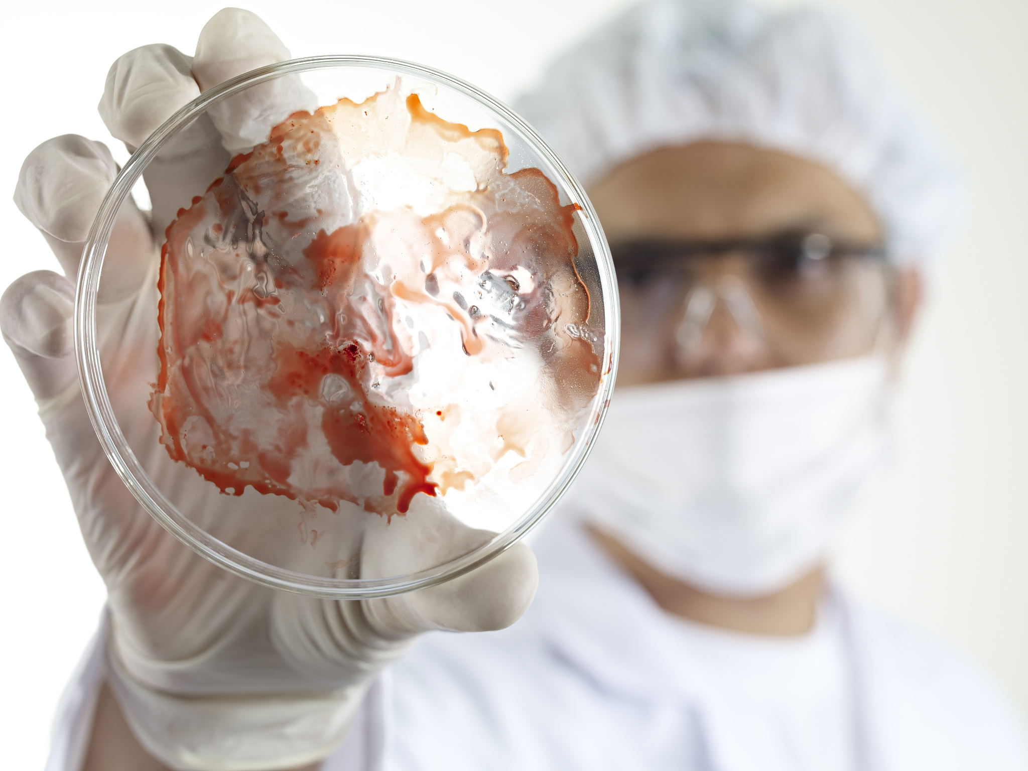 scientist looking petri dish