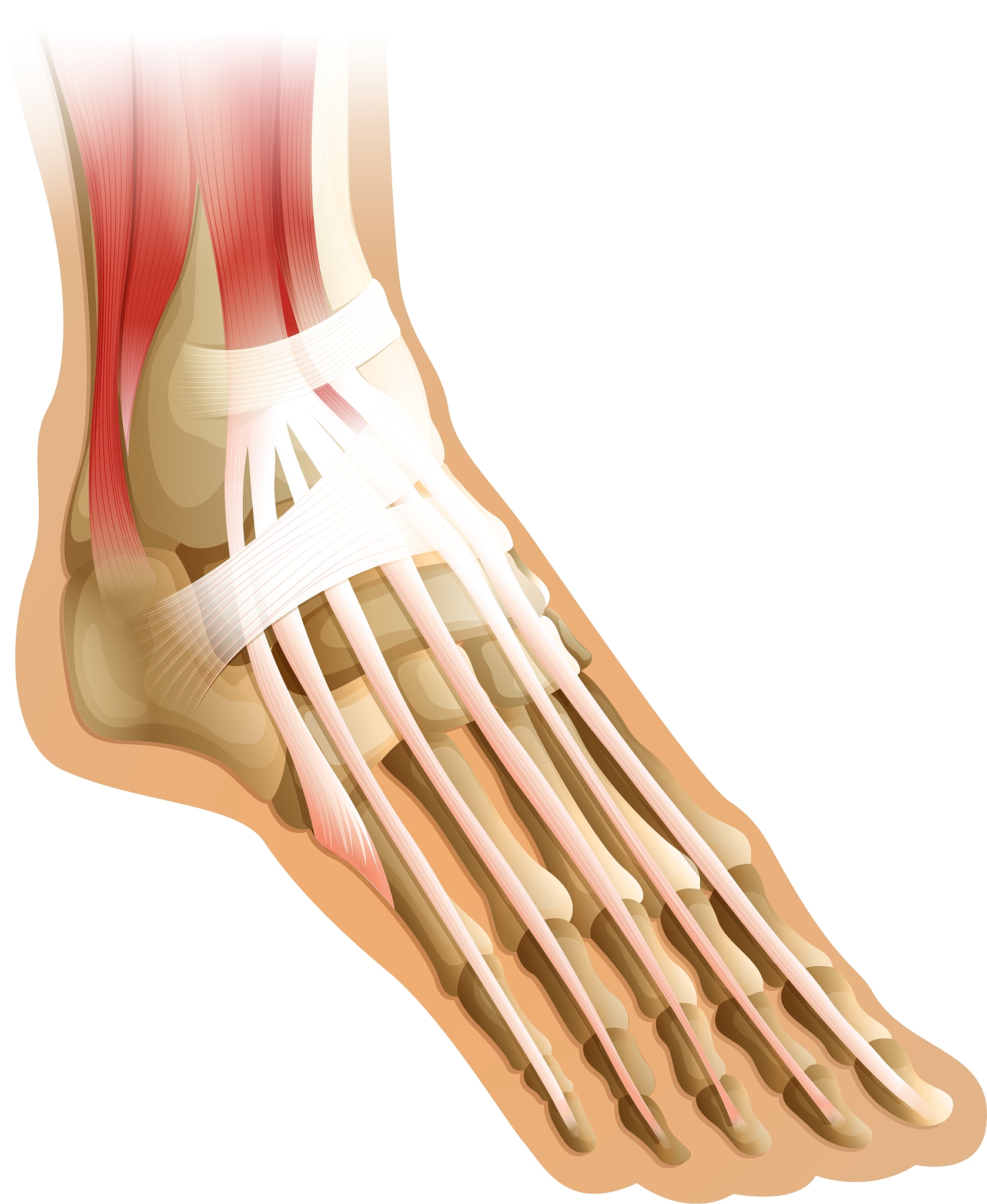 人类脚上有10块肌肉它们分别是1 趾长屈肌负责弯曲大拇趾。2 跗跖肌负责弯曲踝关节和跟腱。3 腓肠肌负责弯曲踝关节和小腿。4 比目鱼肌负责弯曲踝关节和小腿。5 跟腱负责连接小腿和脚跟帮助站立和行走。6 胫骨后肌负责弯曲小腿。7 拇长屈肌负责弯曲大拇趾。8 趾短屈肌负责弯曲小趾和第二趾。9 趾短伸肌负责伸展小趾和第二趾。10 小趾短屈肌负责弯曲小趾。上述内容是否正确