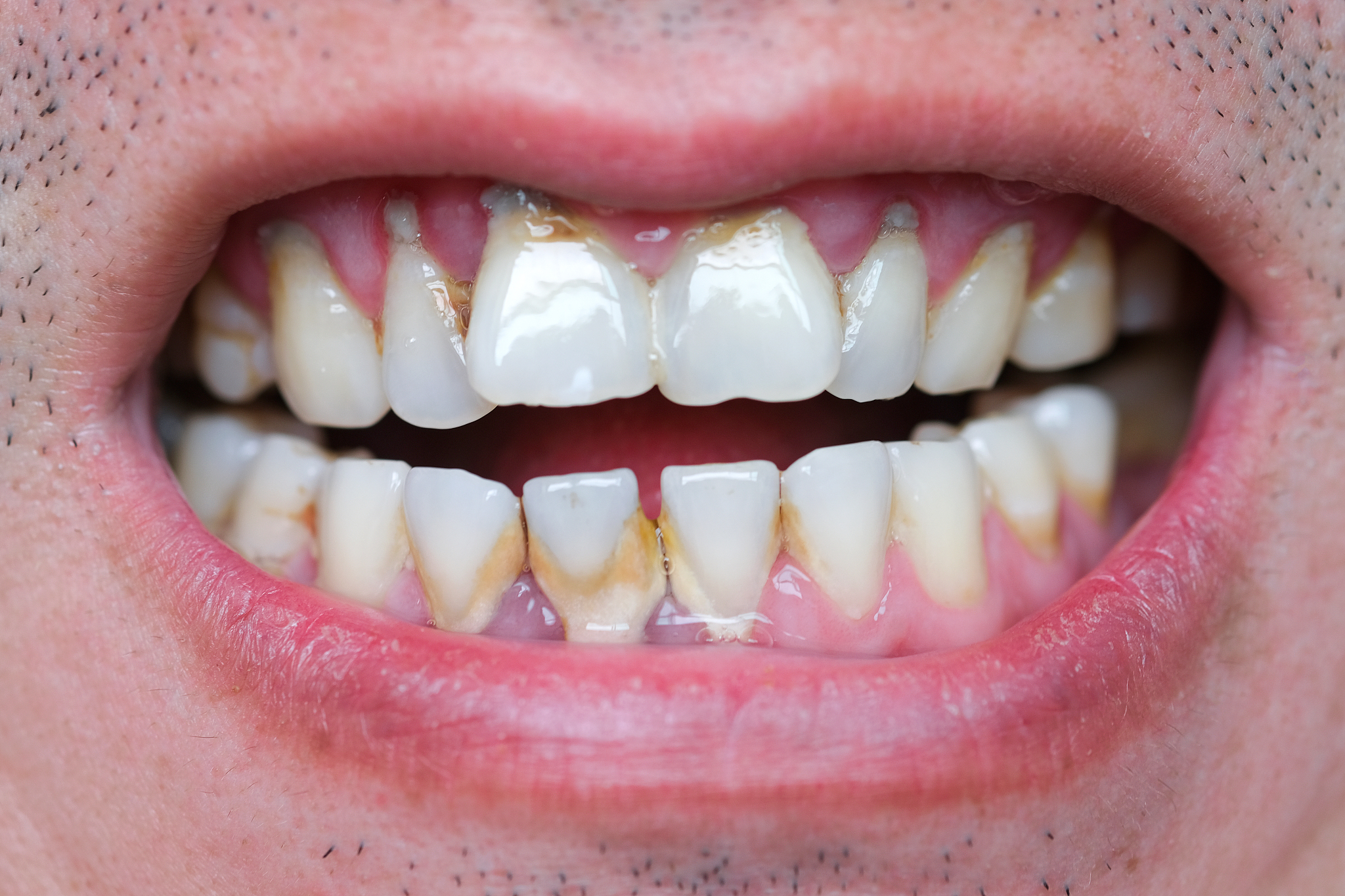 重庆红十字卫校口腔修复工艺专业介绍：让你的微笑更自信