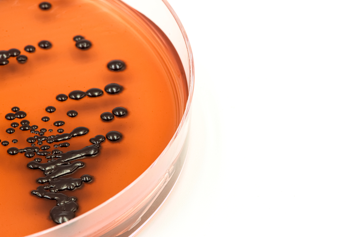 平板倾注法和涂布法计数：菌落差异及培养时间解析