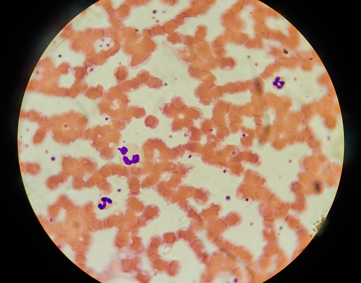 美兰染色：细菌细胞颜色揭示革兰氏染色特性