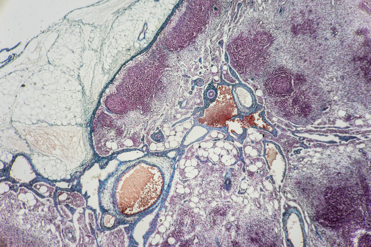 促进线粒体复合物活性对正常细胞和肿瘤细胞的影响