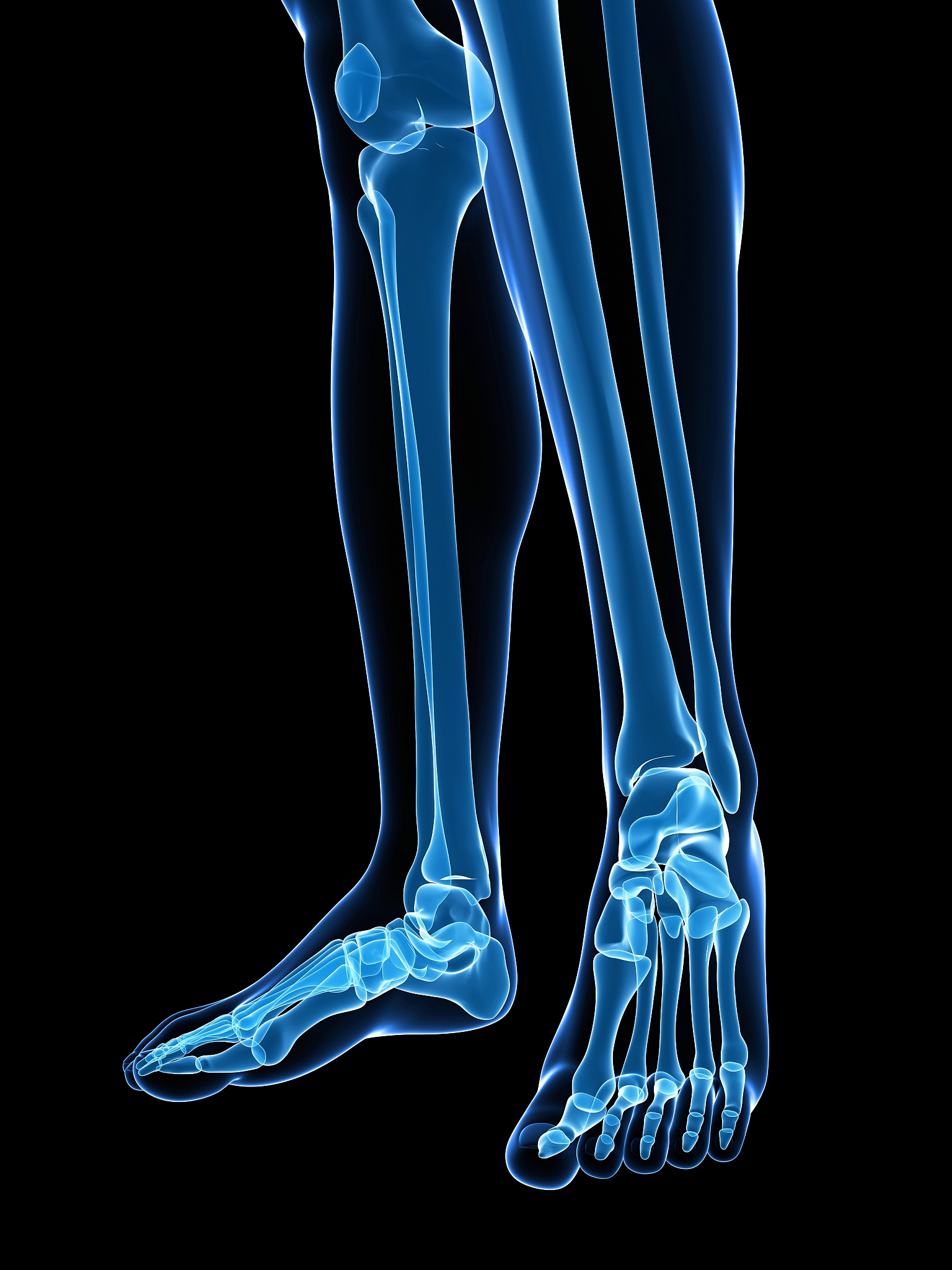 腰间盘突出导致脚后跟疼怎么办？恢复方法和治疗建议