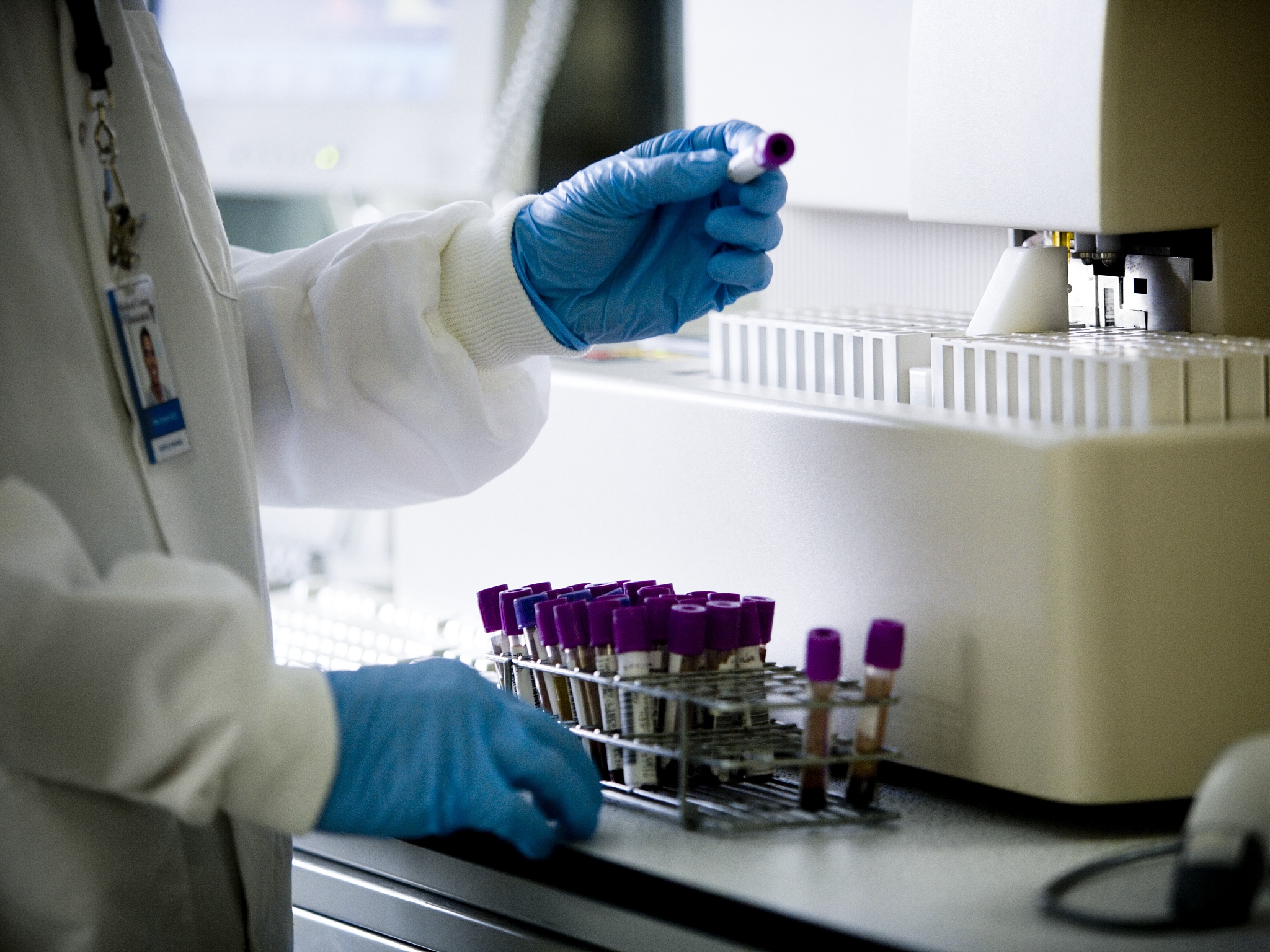 药敏试验：了解您的感染如何对抗生素反应