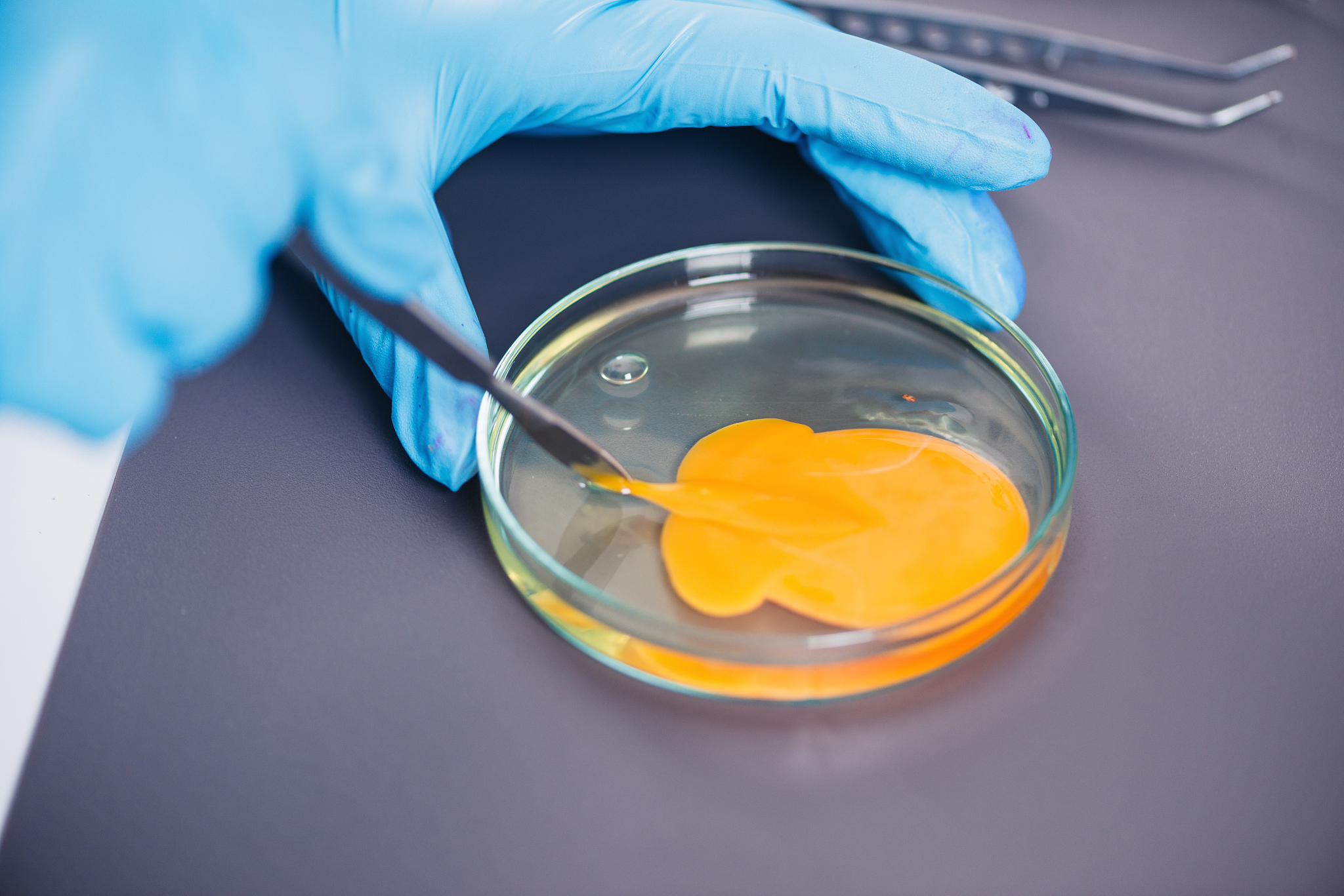 冻胚移植后吃黄豆？科学饮食指南助您顺利好孕