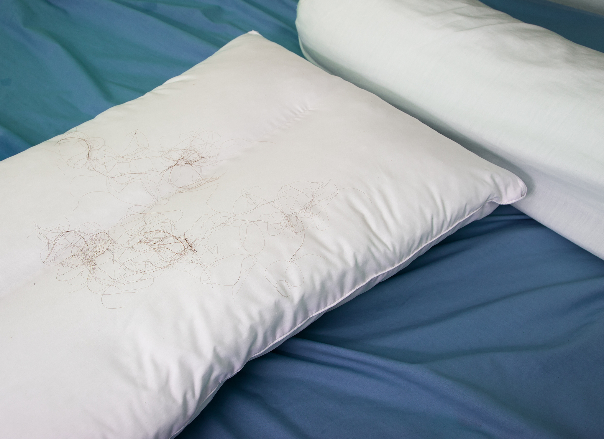 hair loss with pillow on the bed, background