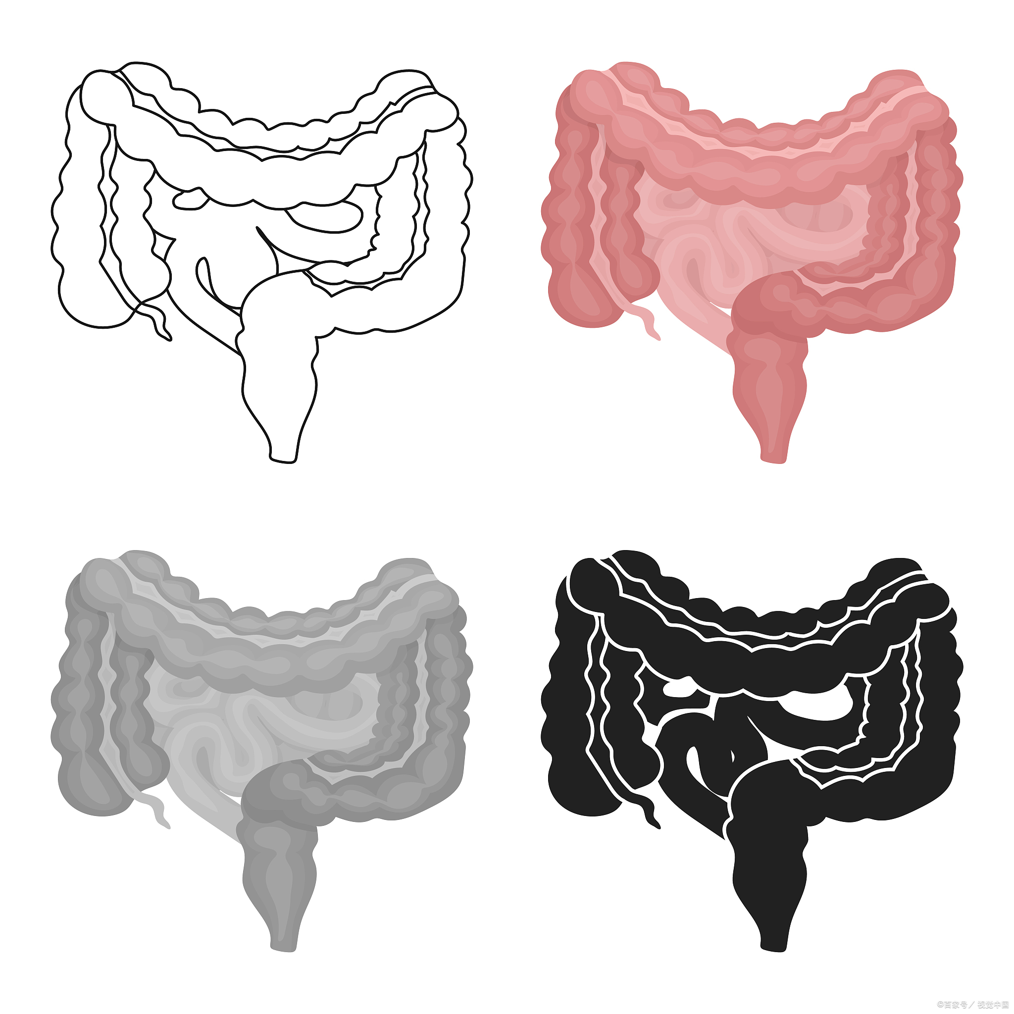 肠梗阻和肠癌症状相似，教你正确区分他们！