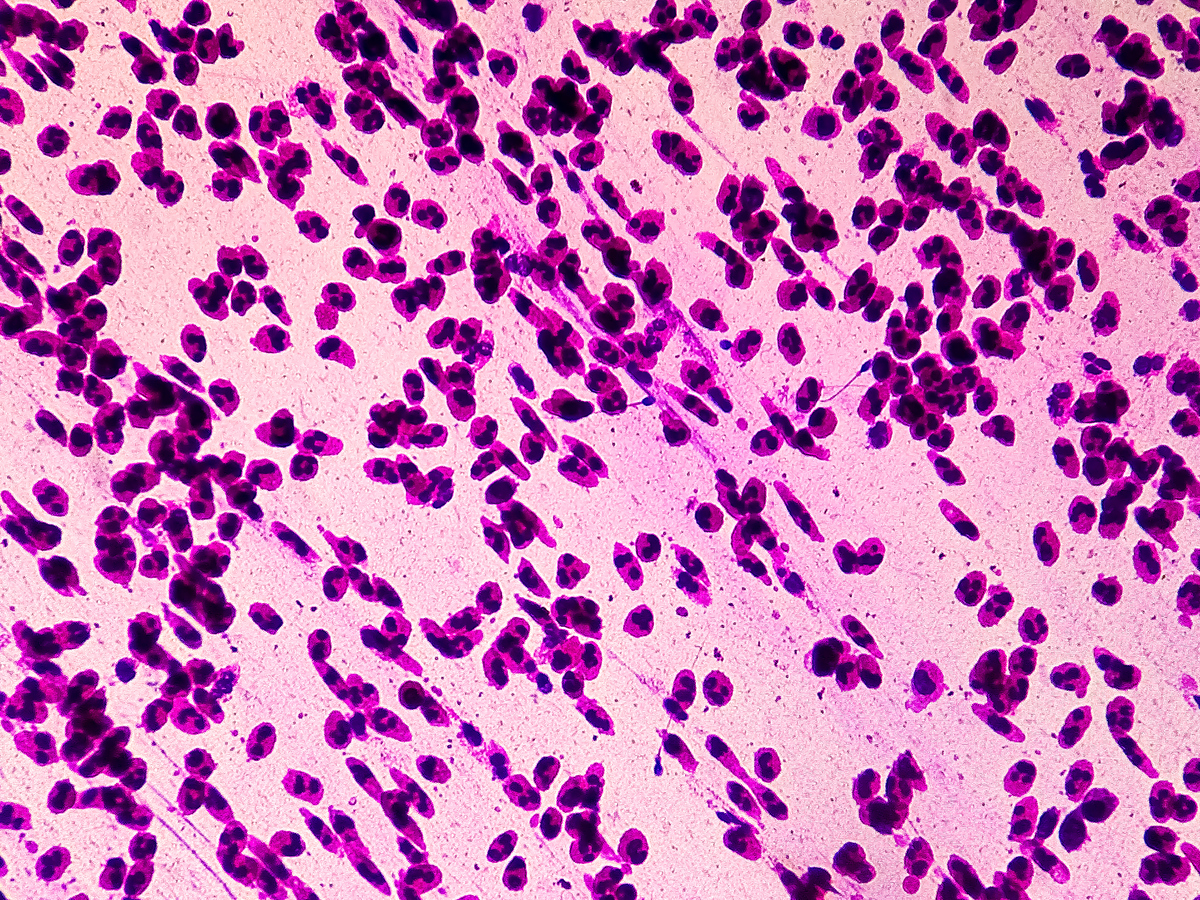 光镜下判断细胞坏死：形态、染色和环境观察