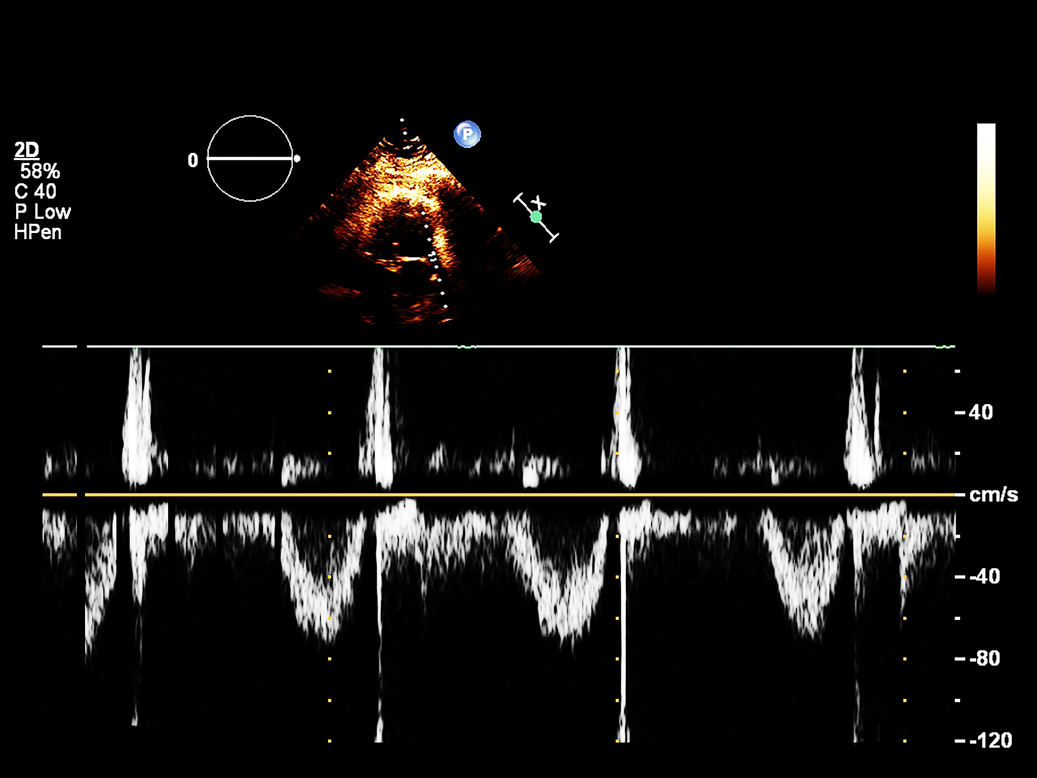 齿轮箱振动信号分析：挑战与机遇