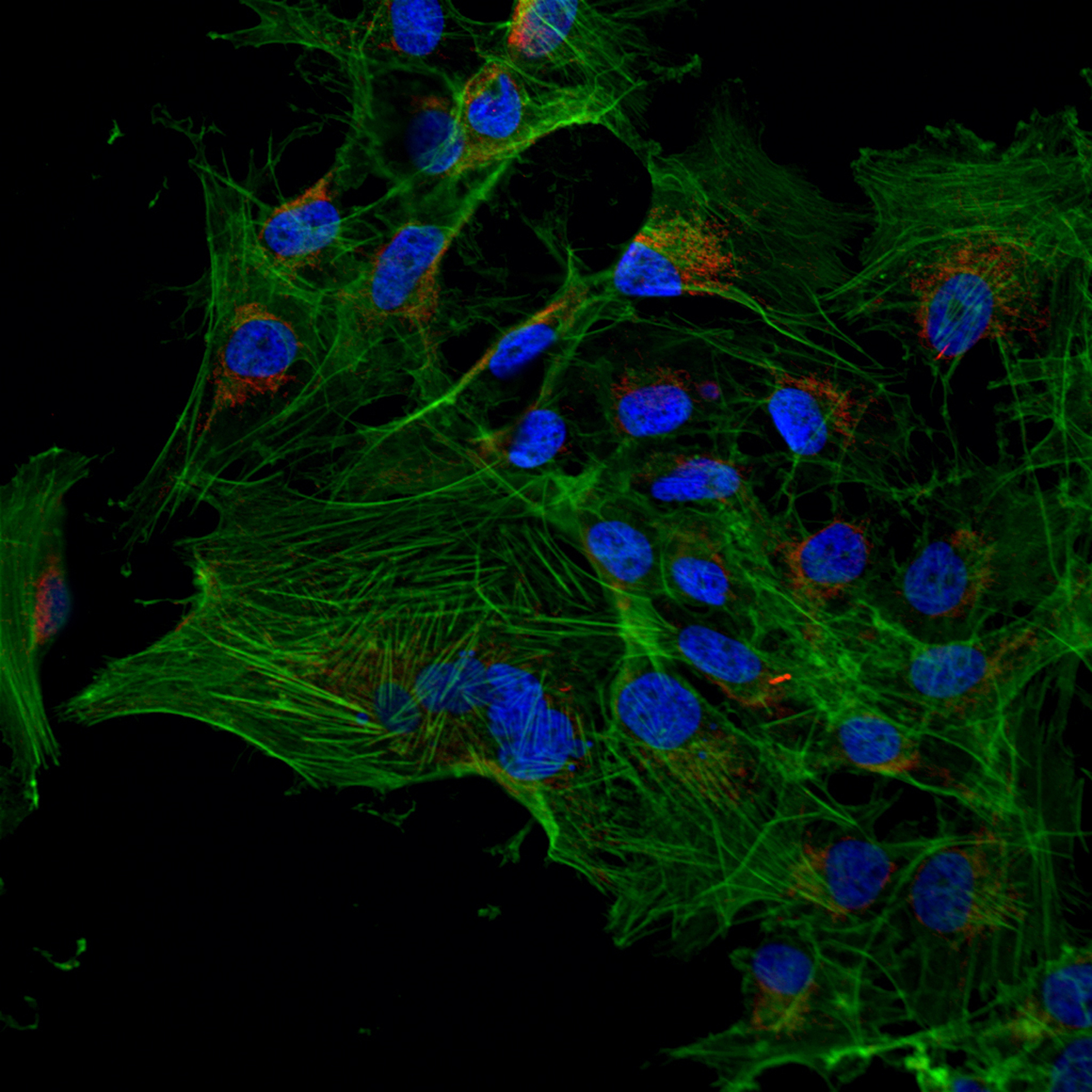 一直以来分子影像学技术因其可视化的优势在生物医学研究和临床实践中发挥了重要作用。其中经典非侵入性成像方式如正电子发射断层扫描PET、单光子发射计算机断层扫描SPECT和磁共振成像MRI等成像方式普遍存在潜在的活体辐射危害、成本高和难以实时成像等问题。