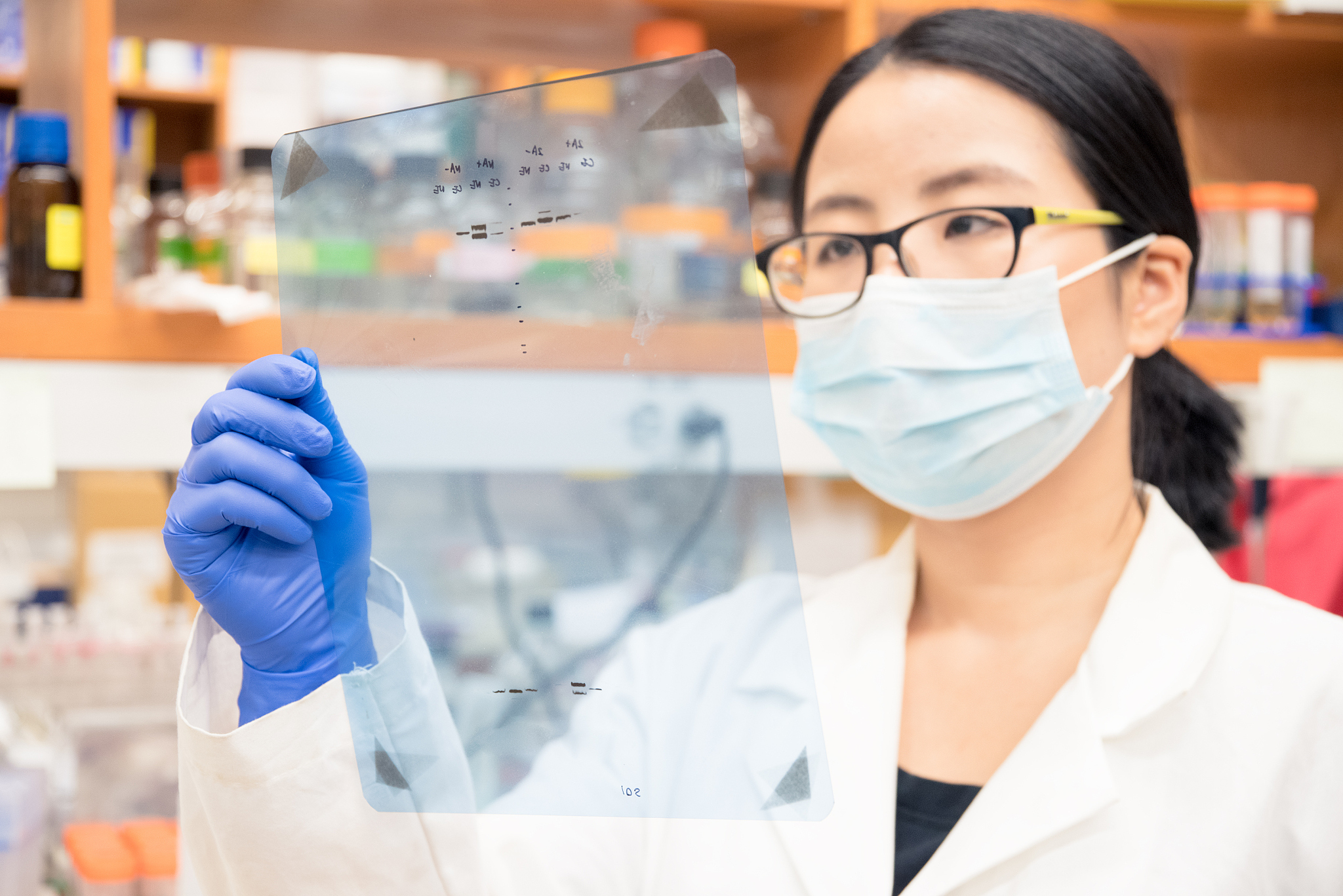 如何用细胞制备样品用于western blotting