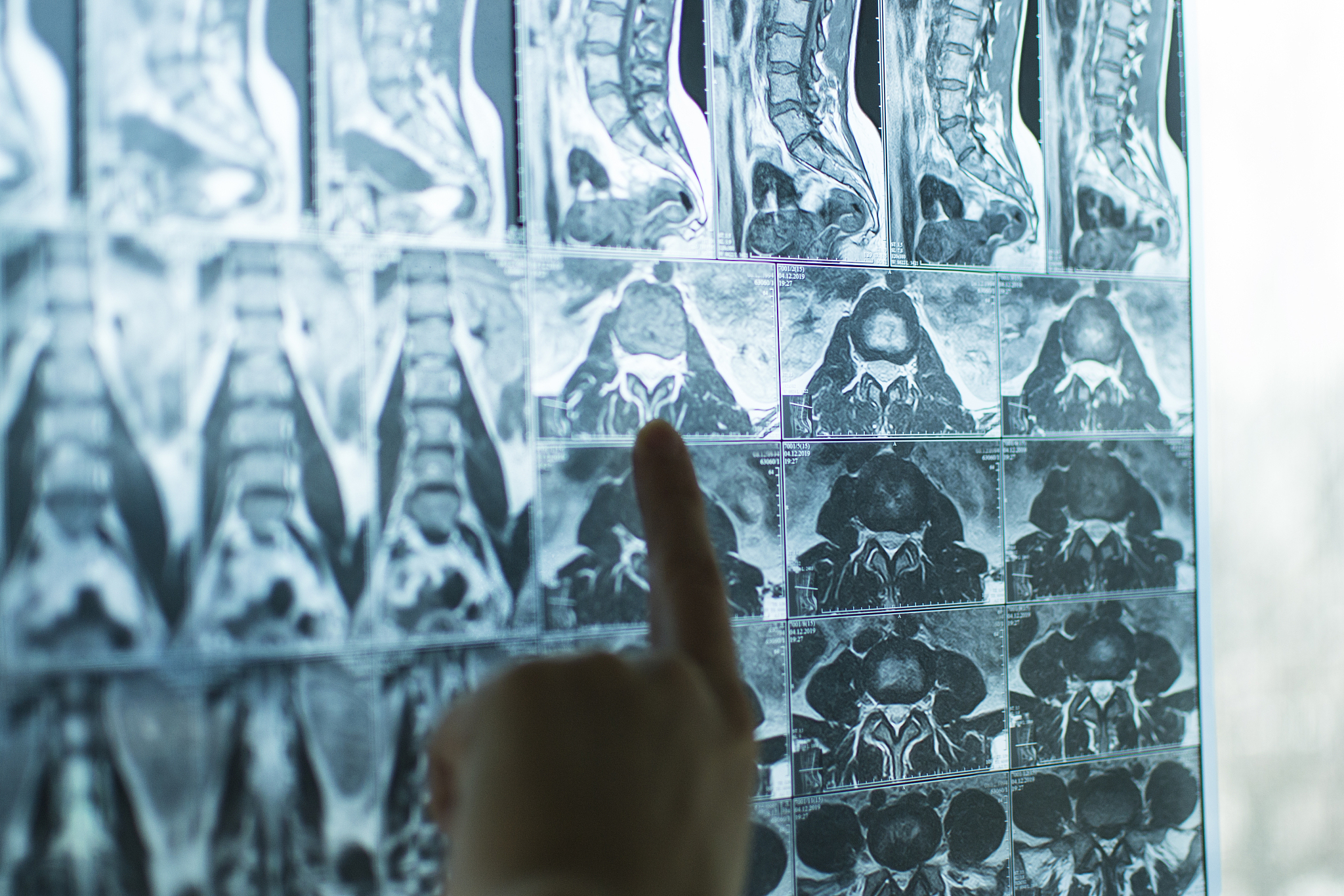 医学影像技术好不好