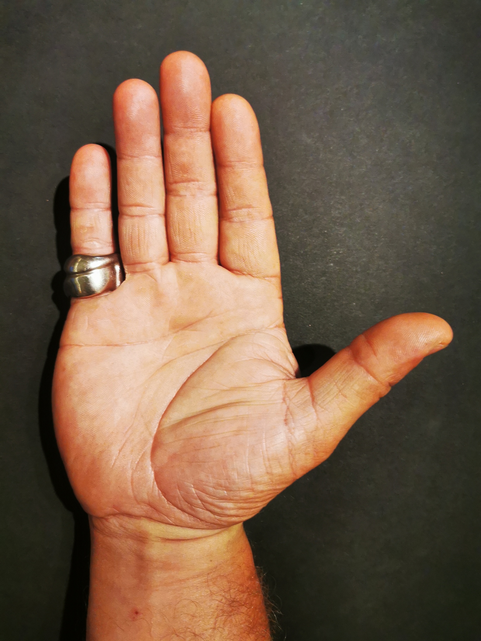 双断掌的人多吗多少人才能出现一个，