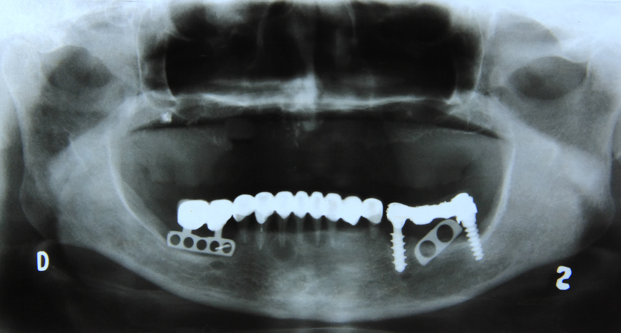 读口腔修复工艺就业前景与专业薪资待遇