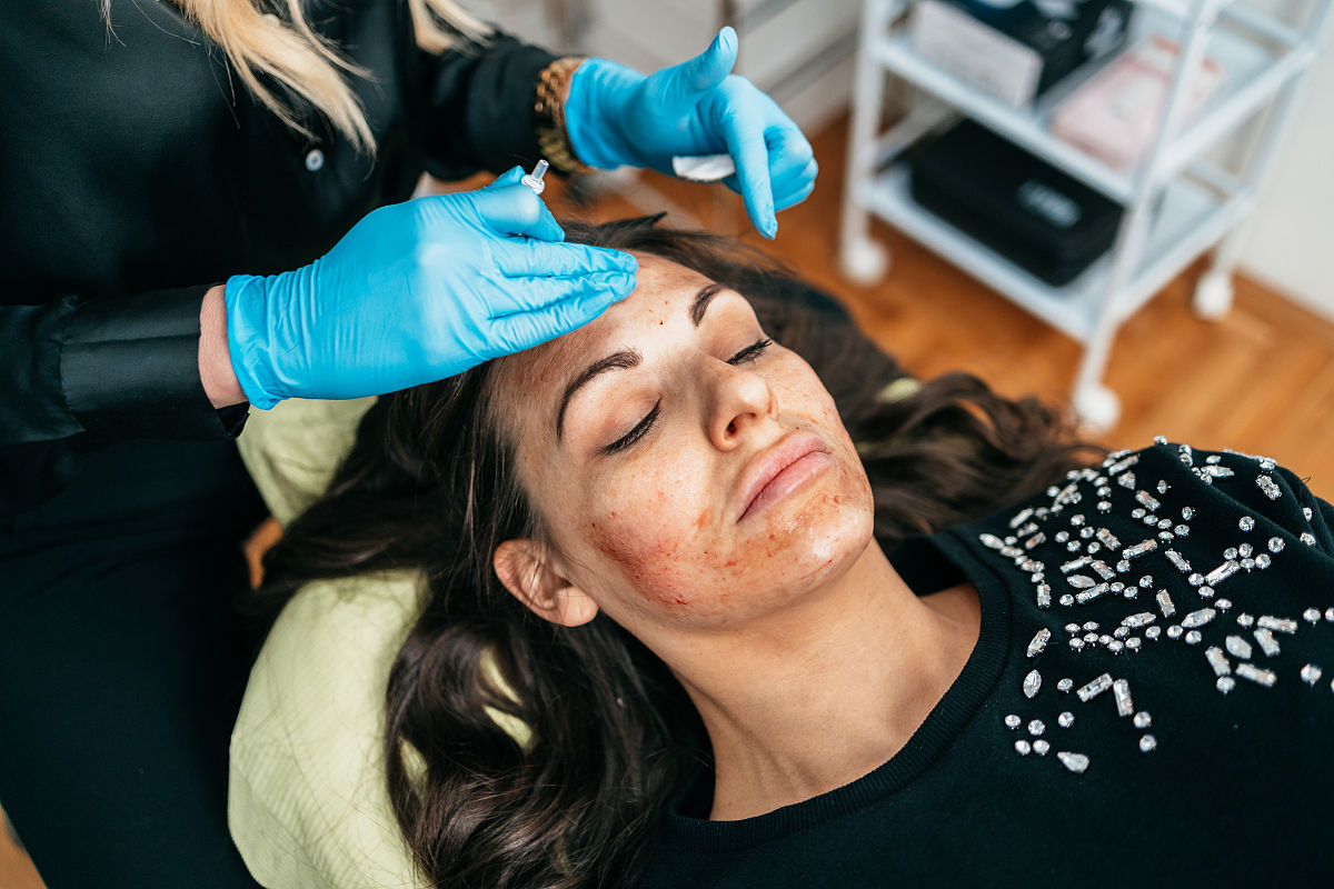 皮肤科的激光美容项目可以分为哪些？详细介绍一下以及说明他们的适应症