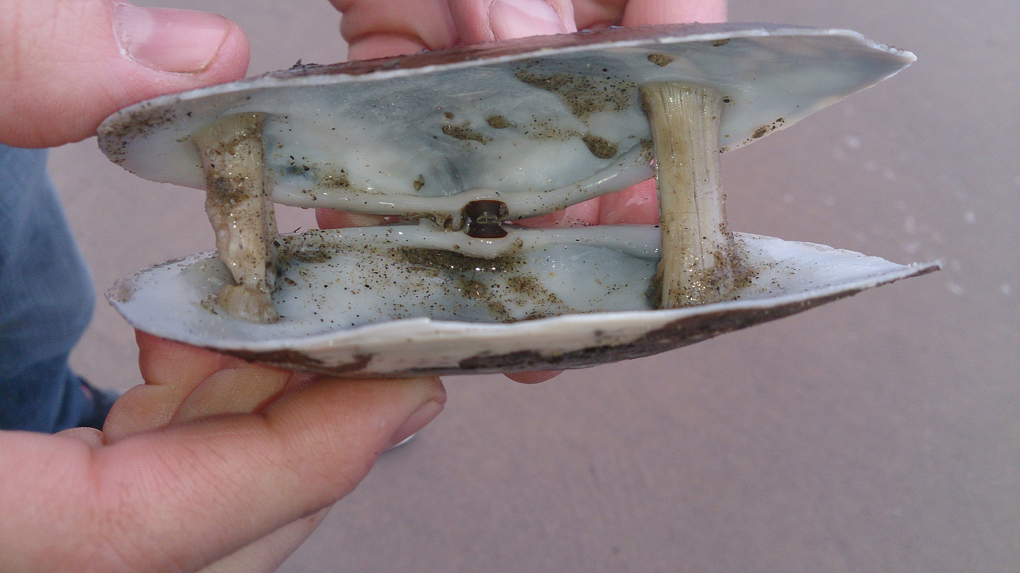 吃海鲜大门牙下面这塞了一个硬壳怎么弄下去