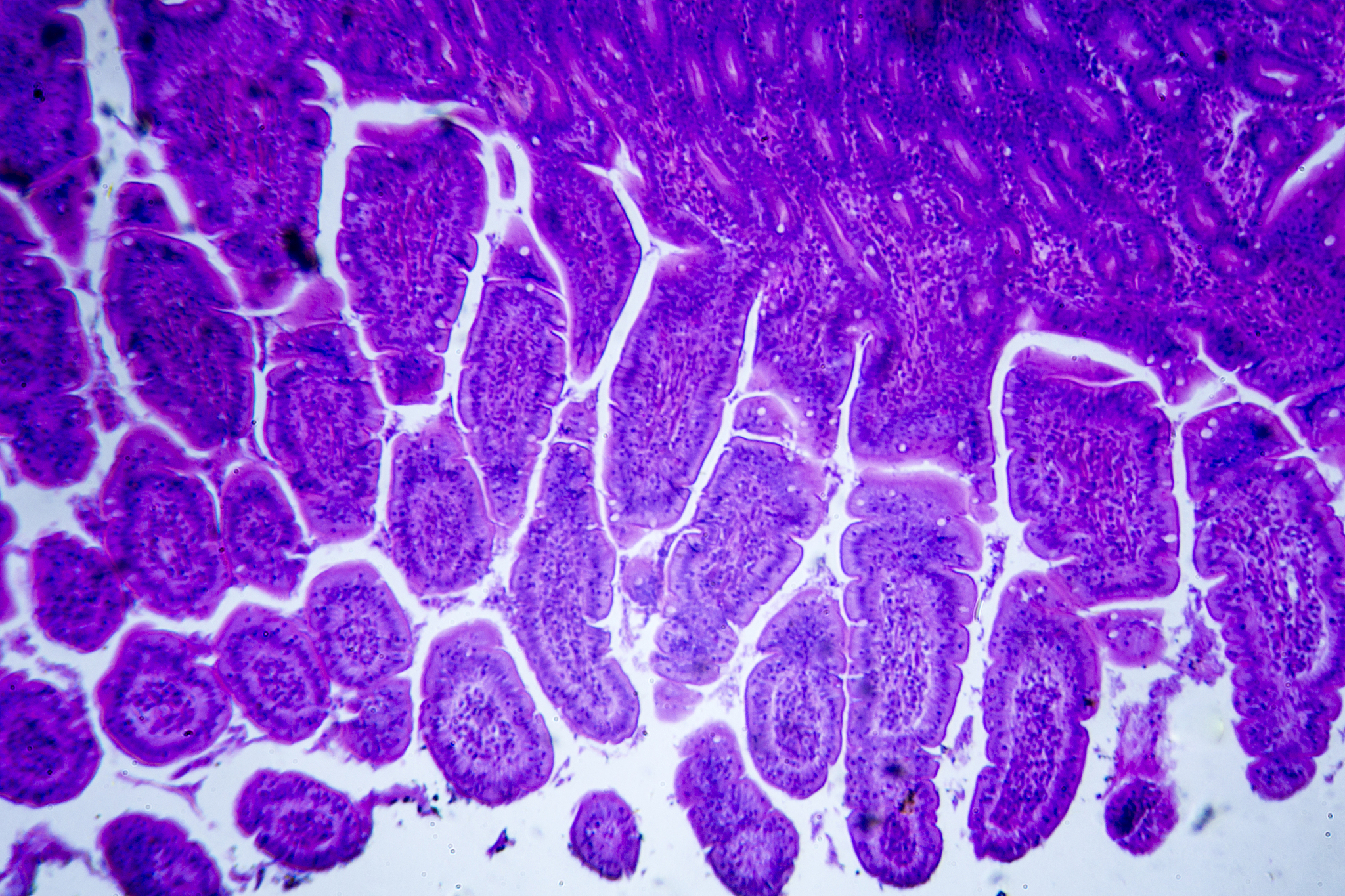 是肠道中的厚壁菌和拟杆菌的比例变低导致了炎症性肠病（IBD），还是患有炎症性肠病导致了这一比例的降低？