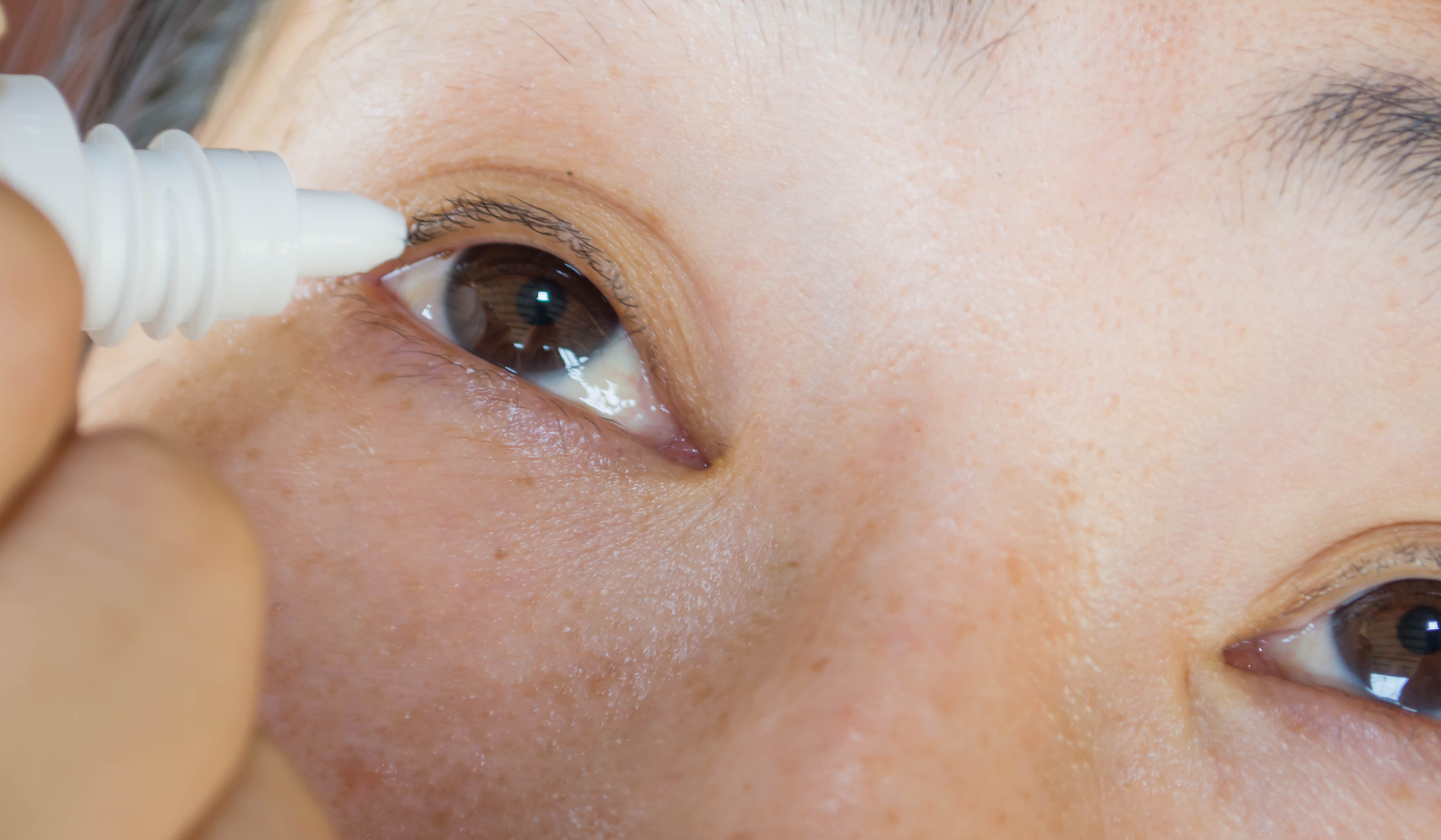 爱尔不得怎么办