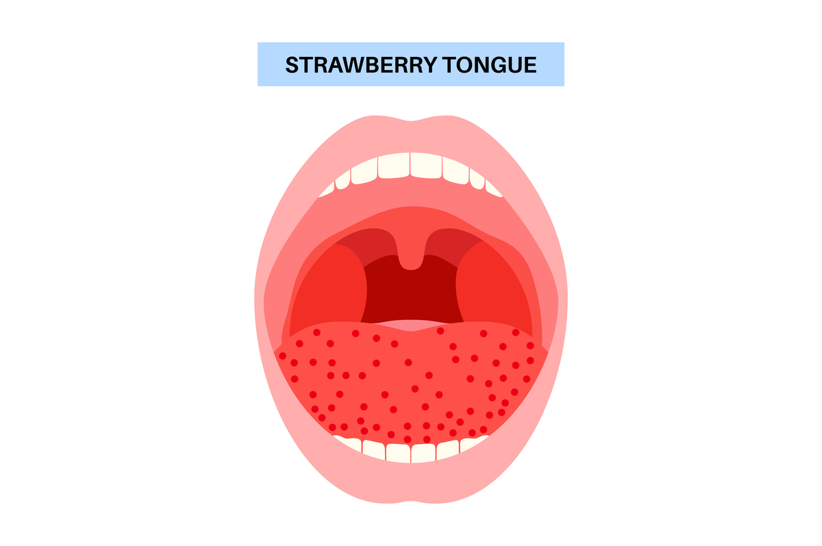 我舌苔发白而且比较厚是怎么回事？吃点什么药？