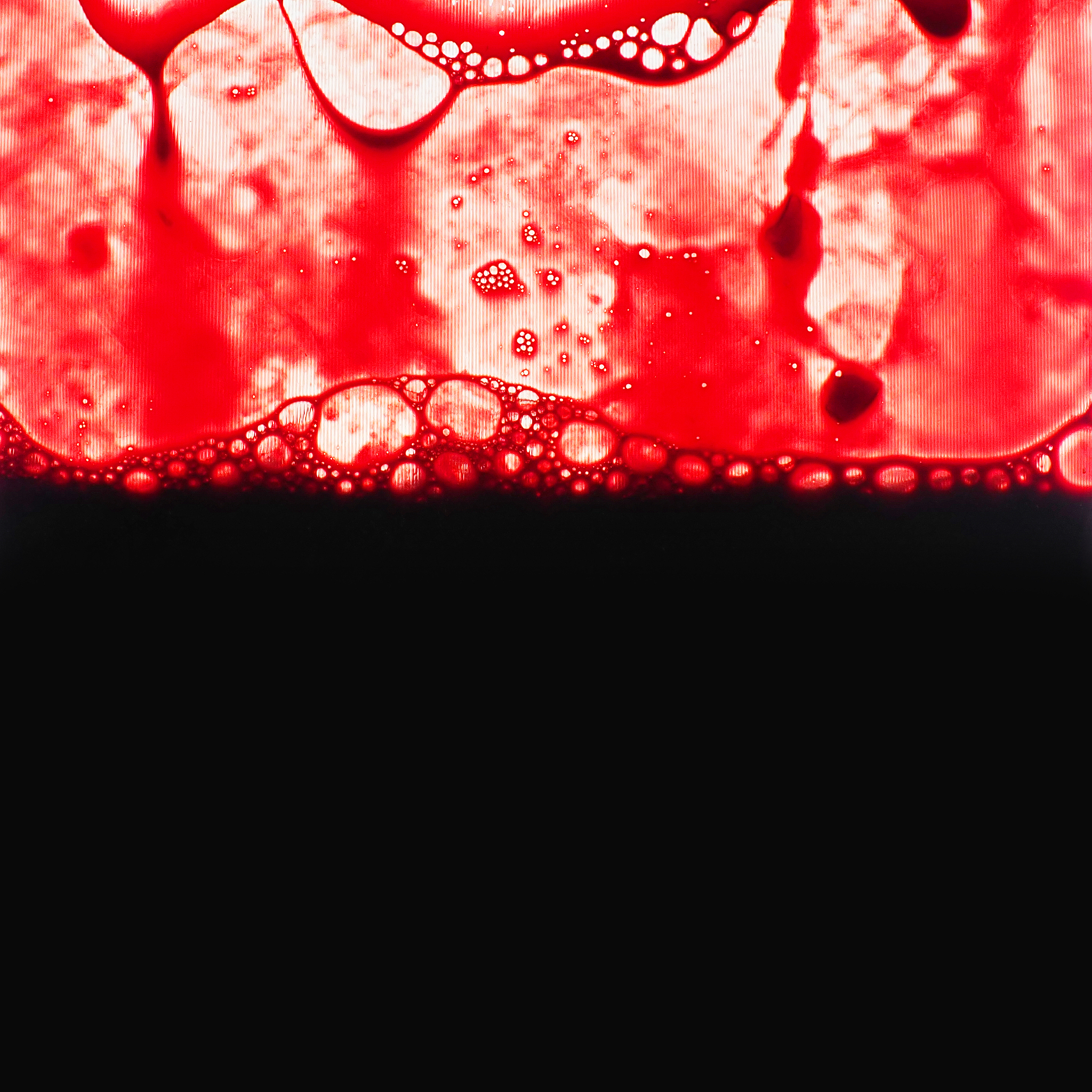 select ibmdBLOOD_PACKET_SERIAL_NO as bloodbagibmdblood_name as pat_nameibmdTRANS_CAPACITY as amountibmdBLOOD_TYPE bloodgroup ibmdRH_TYPE rhibmdUNIT unitto_charibSEND_BLOOD_TIMEyyyy-MM-dd hh24mi out_da