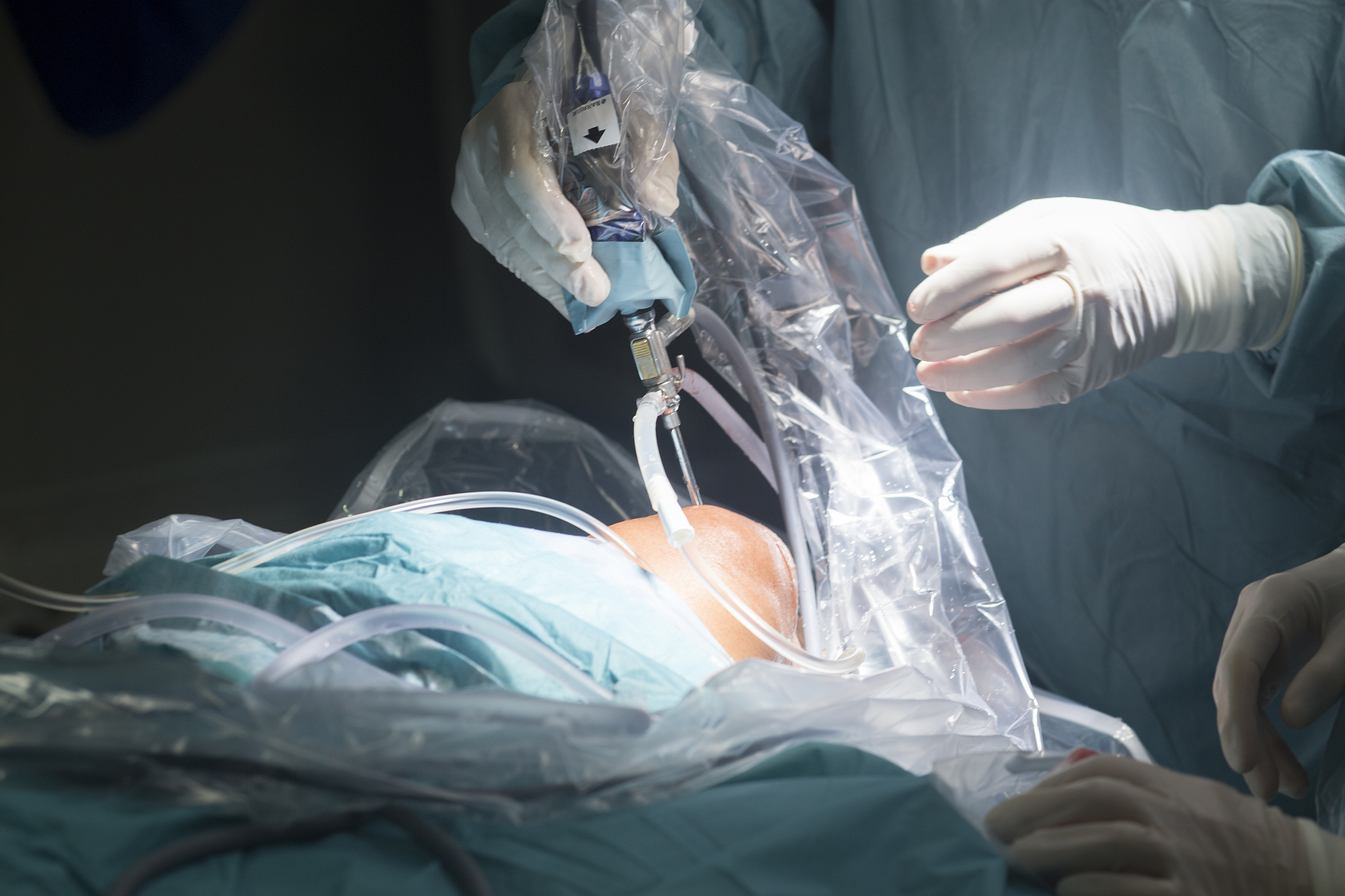 knee keyhole surgery hospital arthroscopy operation medical proc