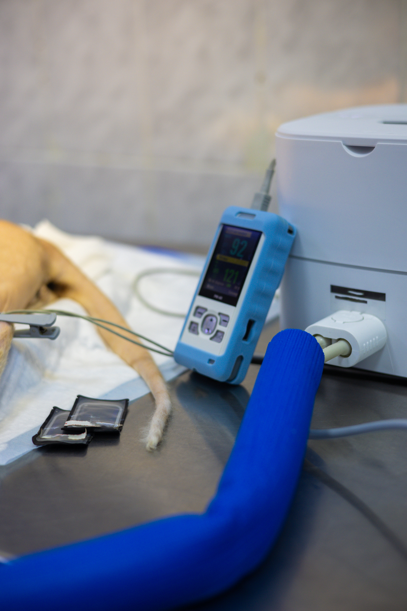 肌电传感器：原理、应用及类型