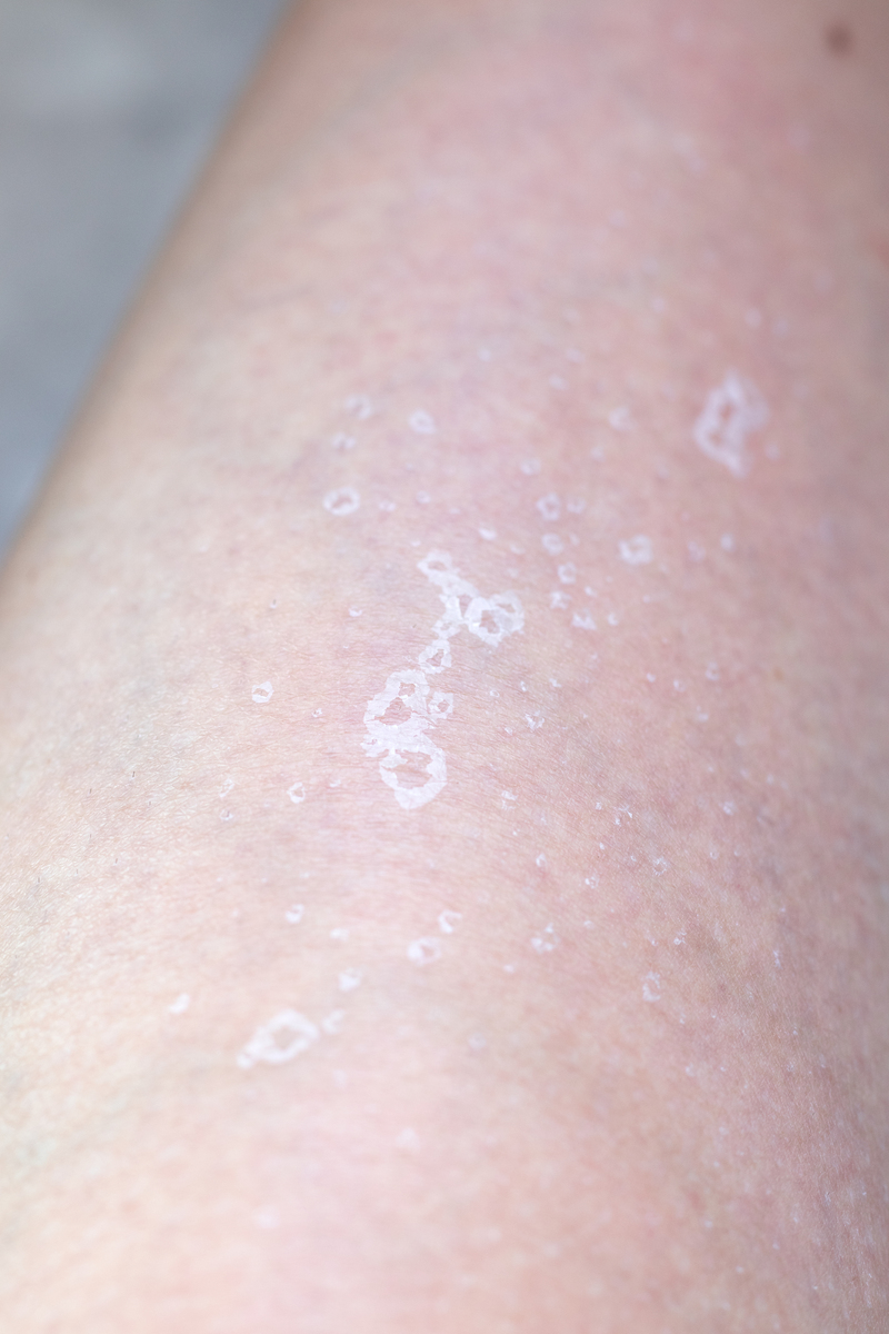 衣服上的汗斑黑点怎么洗？4个方法轻松搞定！