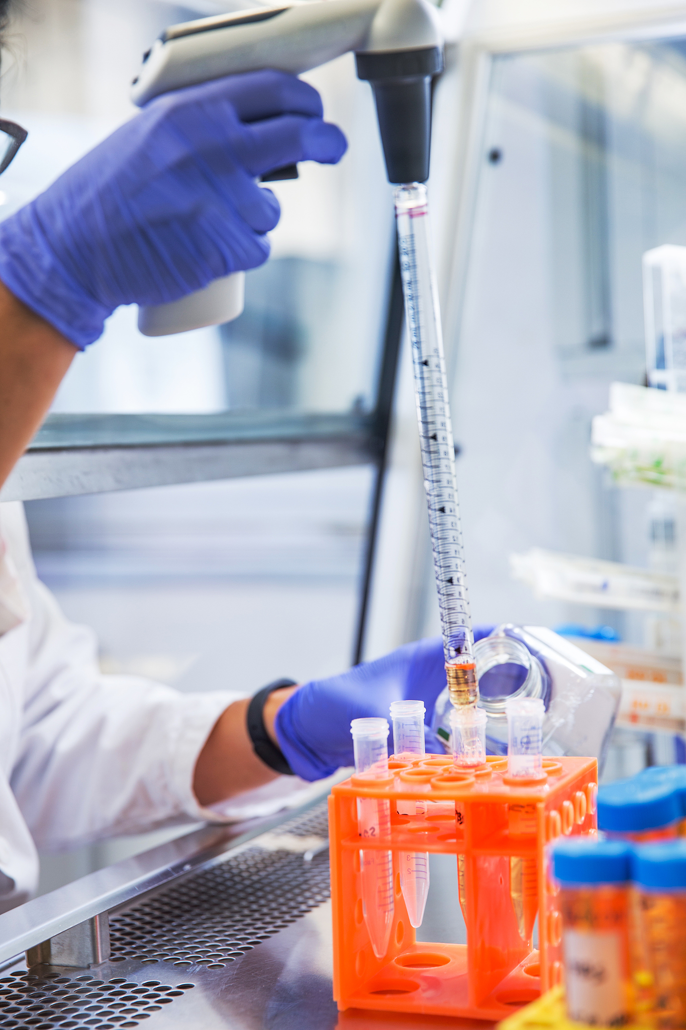 学医学检验技术专业要学习哪些专业课程