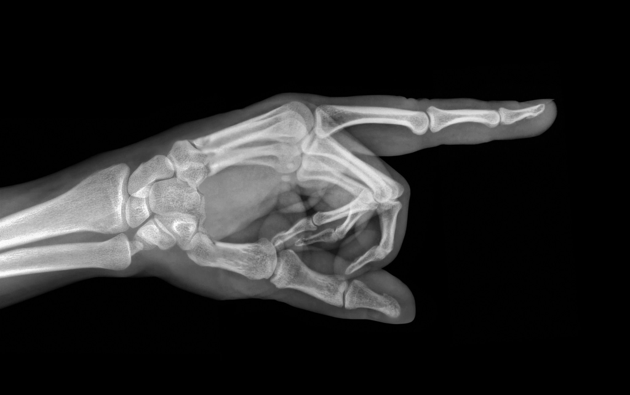 射线底片验收标准繁多？如何解决？