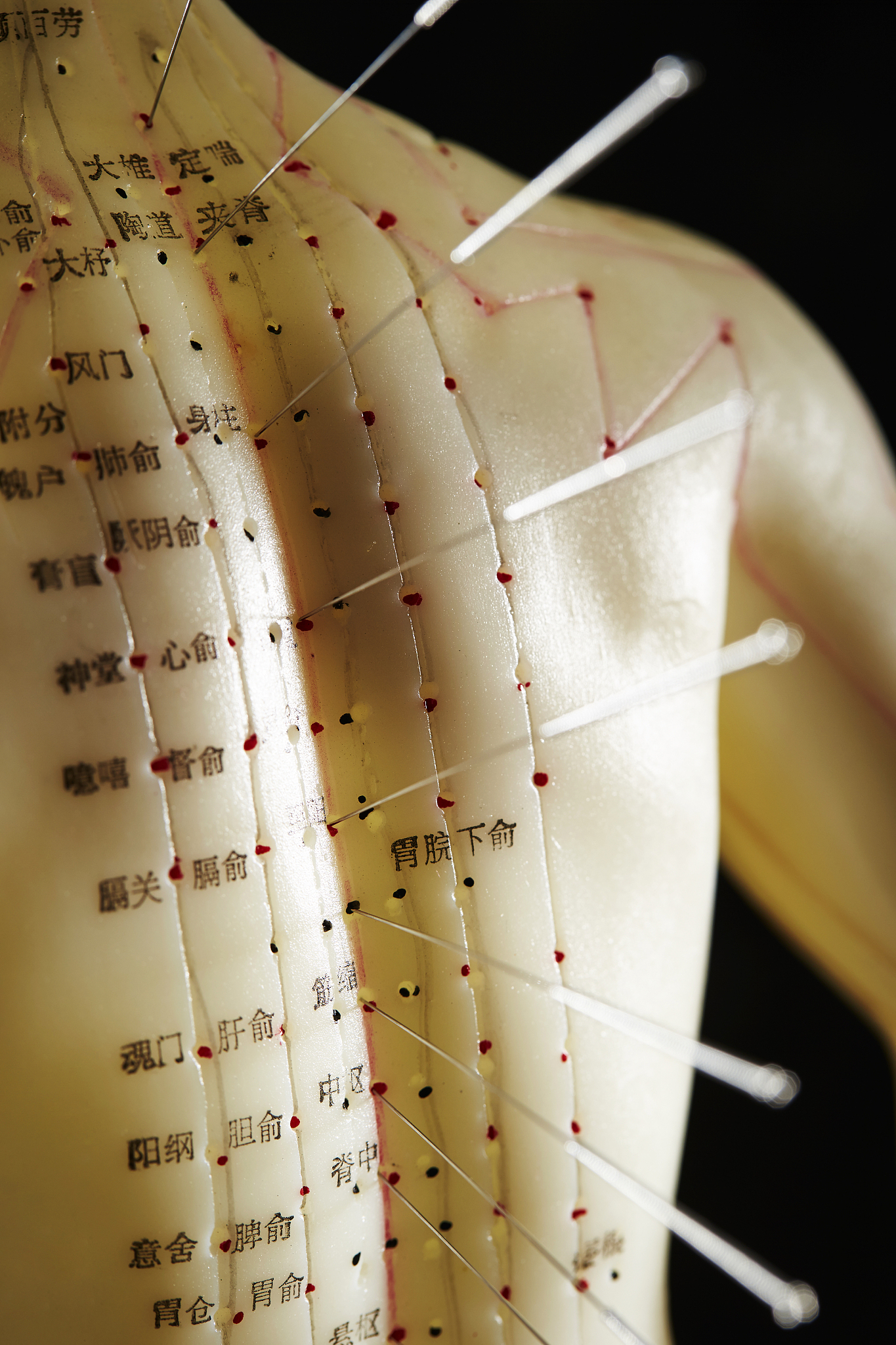 针灸治疗腰椎间盘突出: 深入解析其作用机制