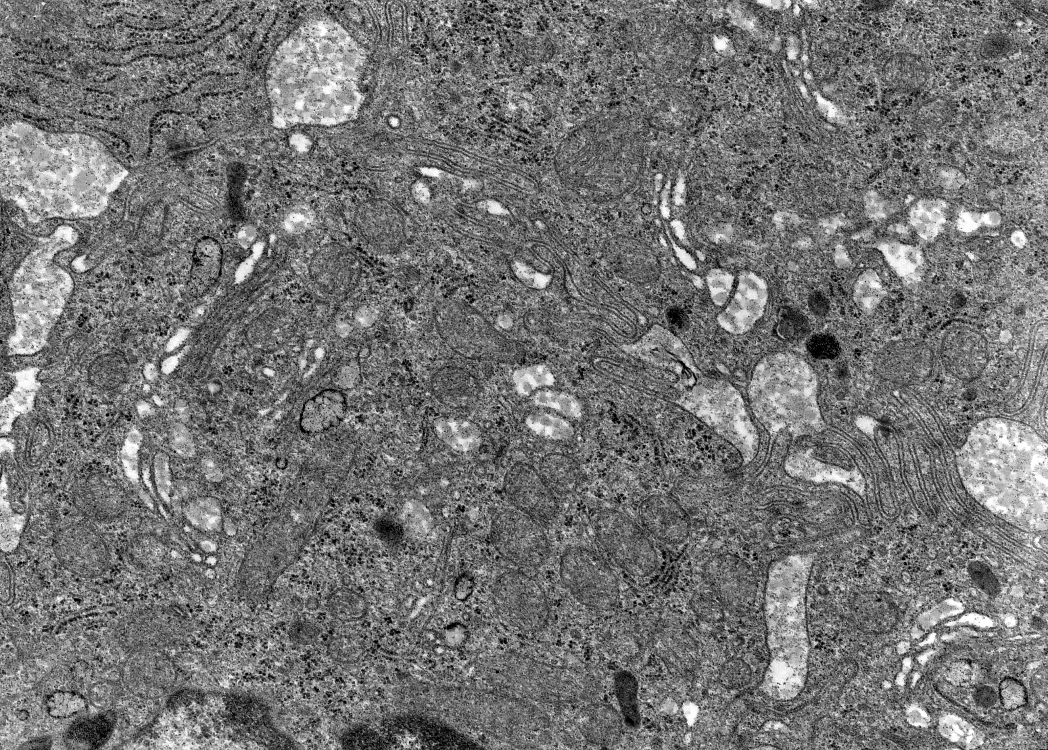 Moreover the detailed analysis about heterojunction properties of AR-TiO2 have added in the Section of mechanism analysis lines 12-27 on page 20 The details are described as follows用科技英语完善