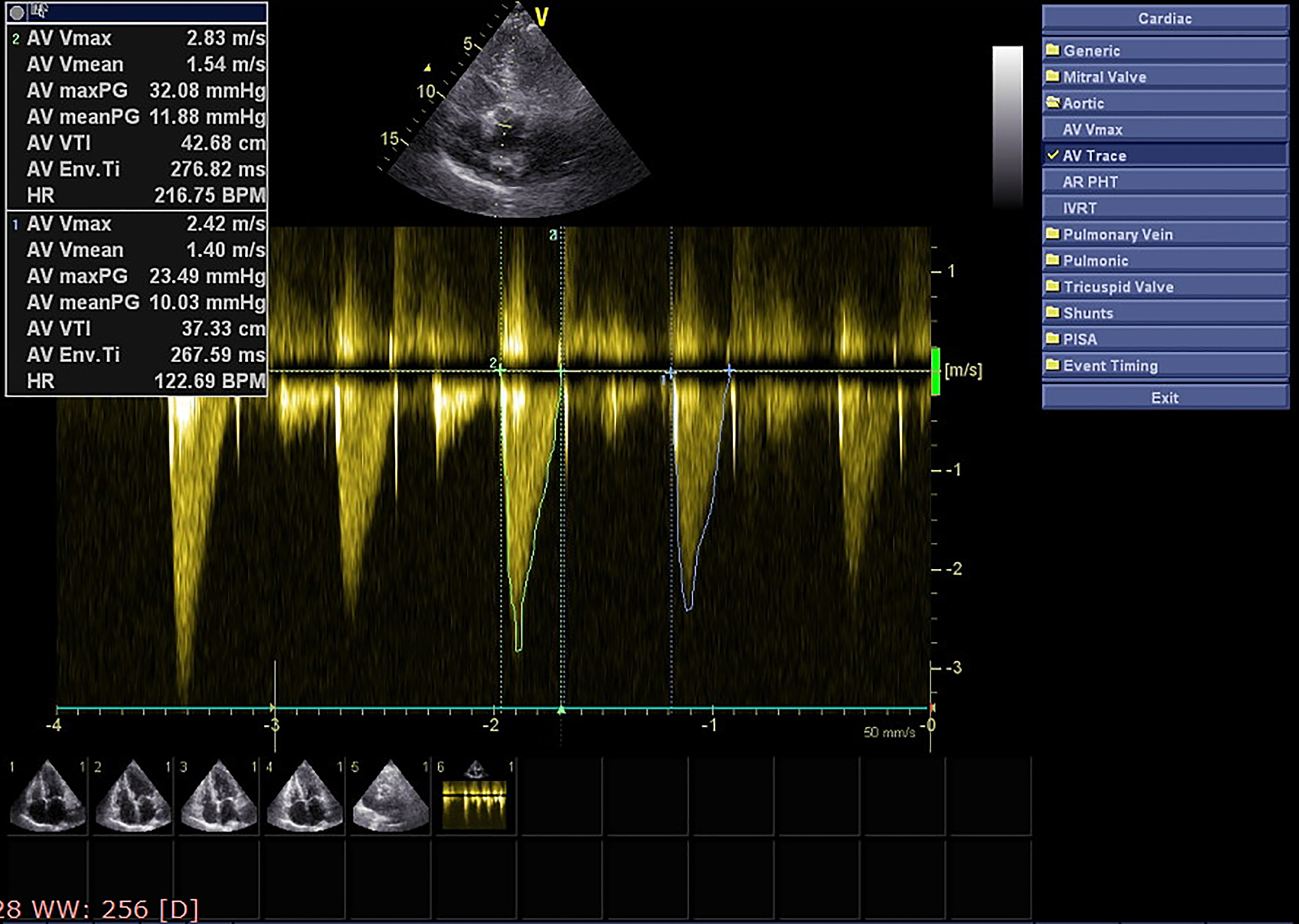 ISAR成像中运动补偿技术详解