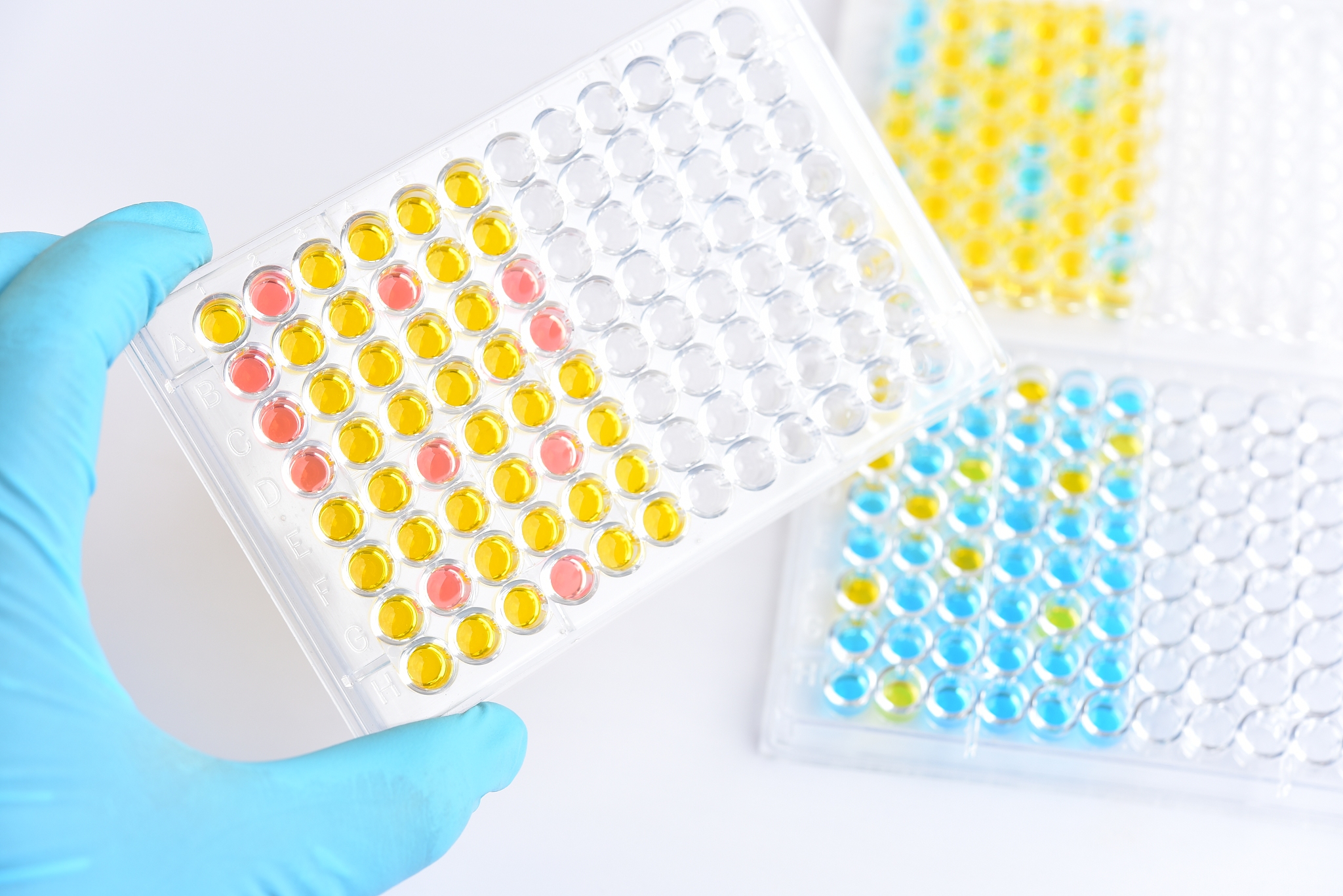 ENZYME AND MICROBIAL TECHNOLOGY 期刊投稿指南：稿件类型详解