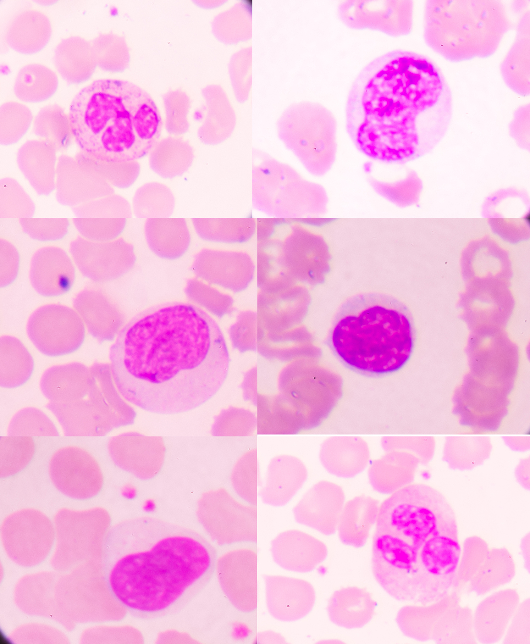 荣格牌鱼油软胶囊需要长期使用吗？