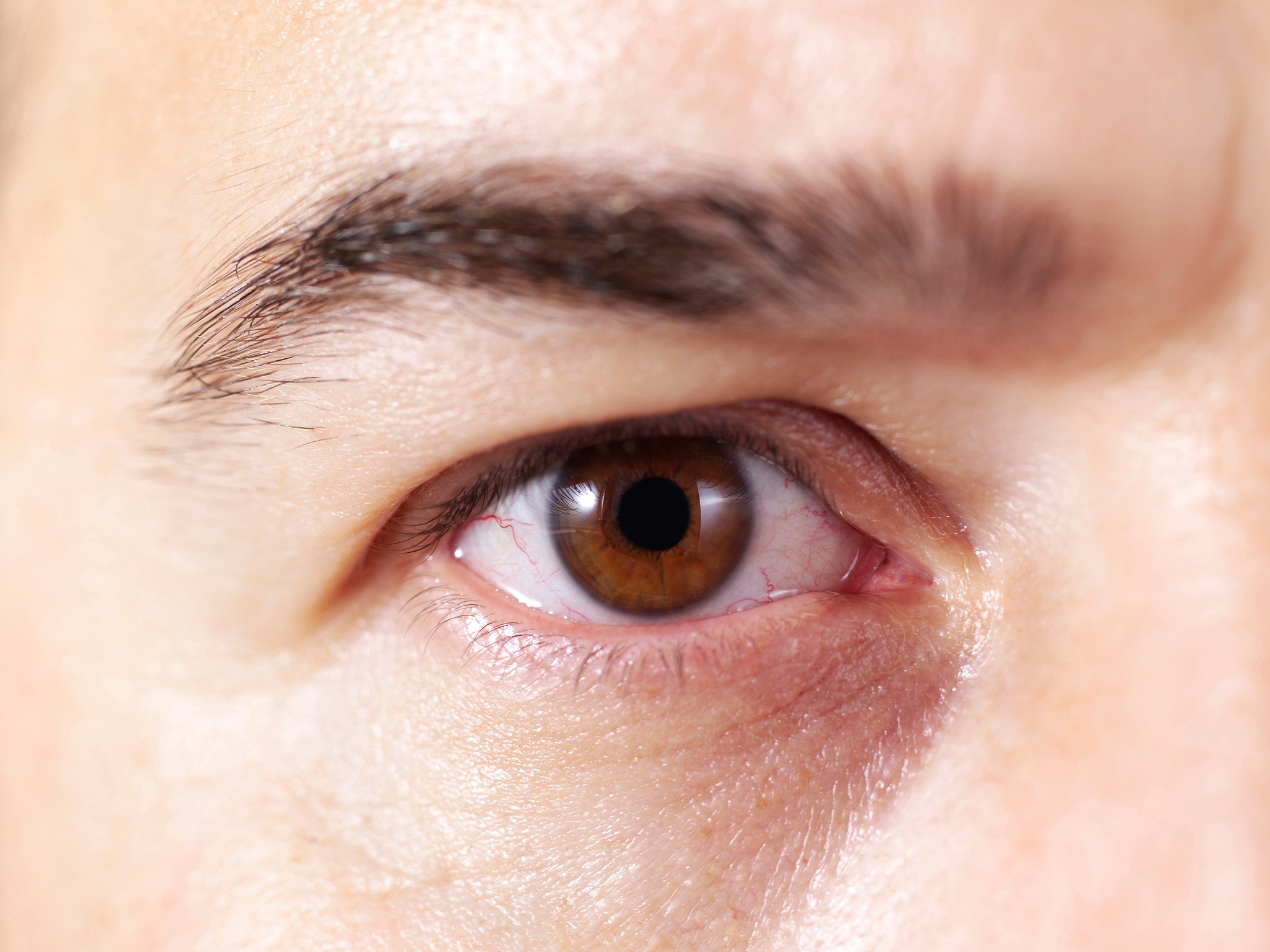 20+男生 15天淡化顽固眼纹 亲测有效！